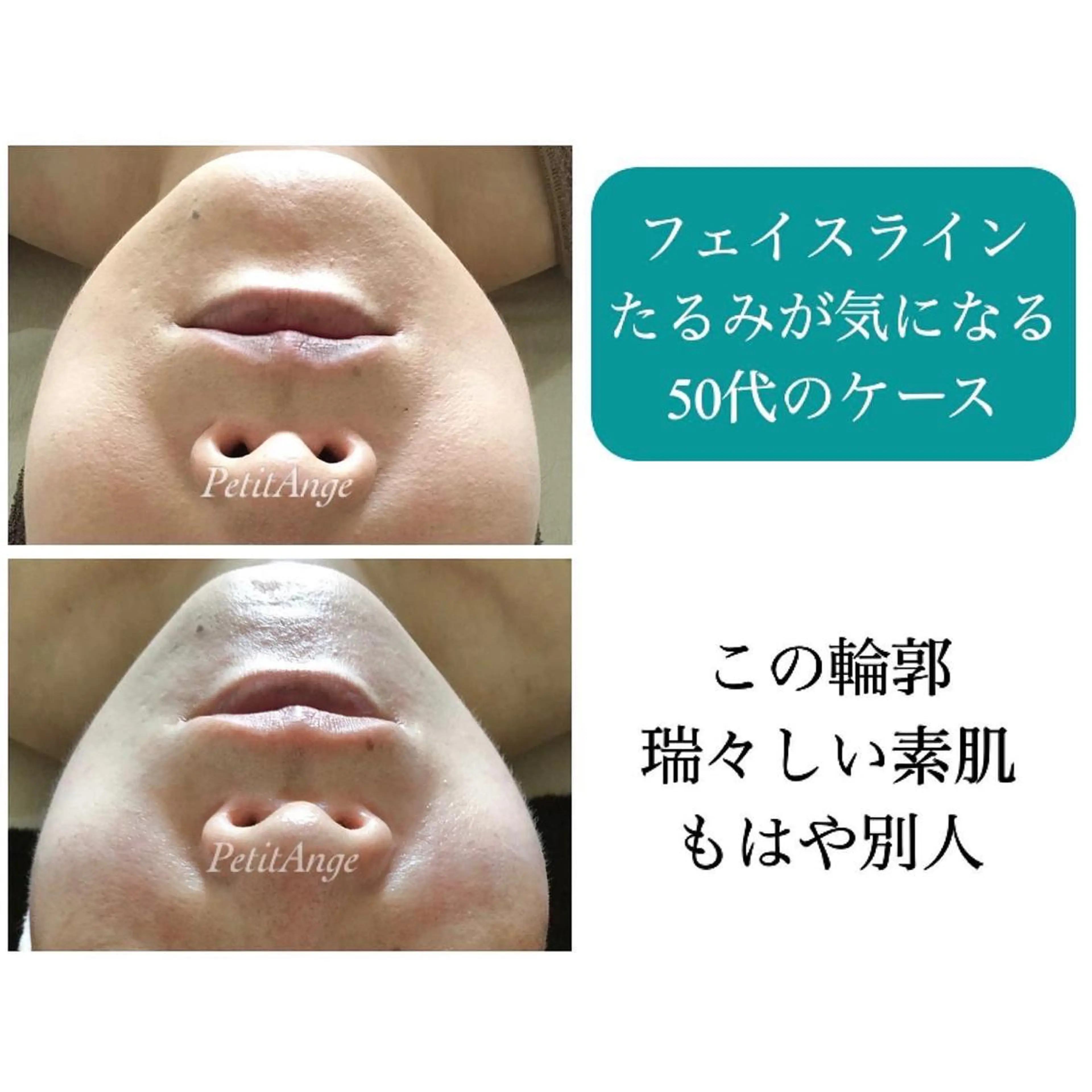 艶肌&小顔リフト❤︎ プチアンジェ茅ヶ崎のエステ・リラクイメージ