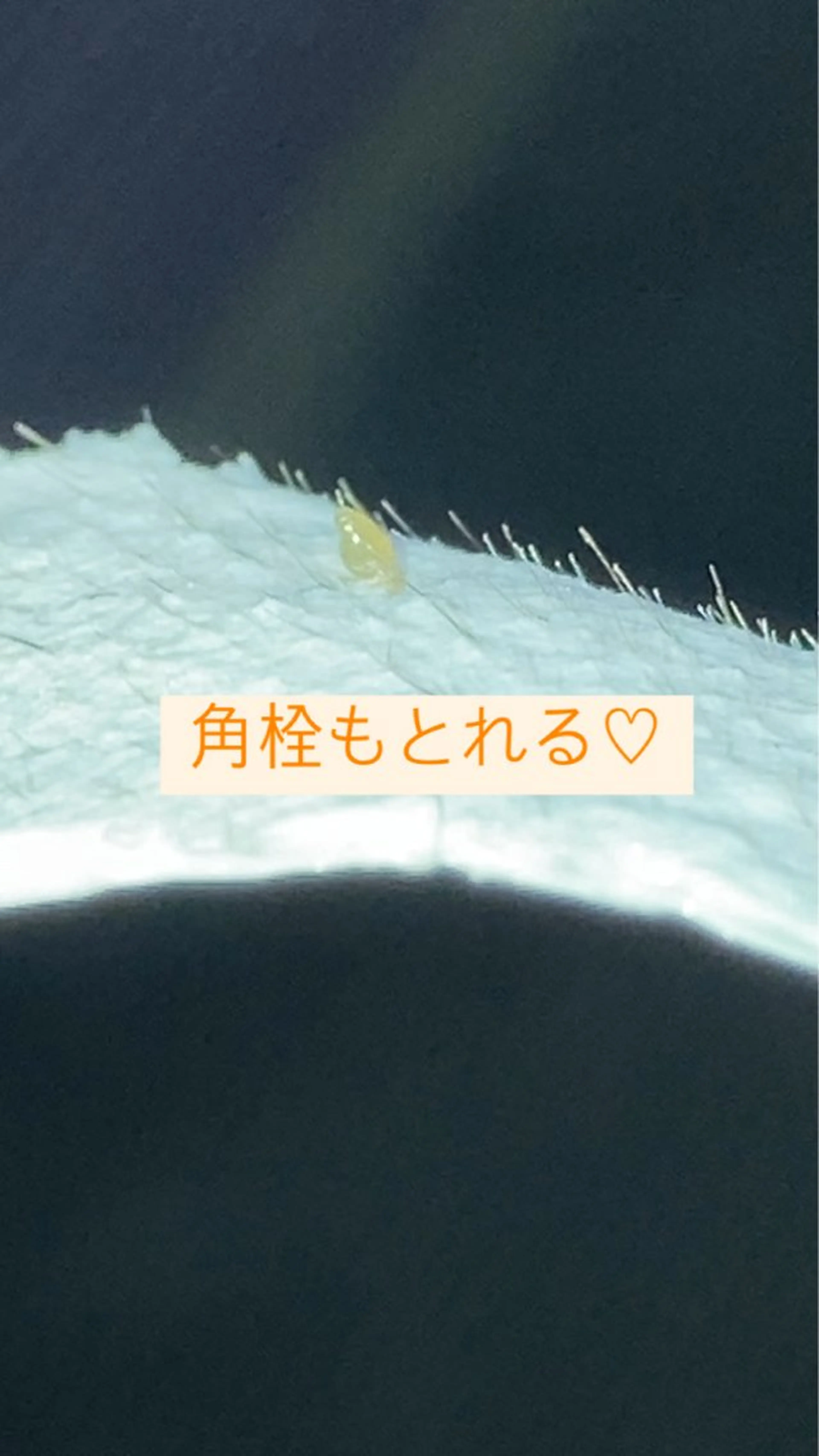 脱毛 産毛専門店 Bittoのエステ・リラクイメージ