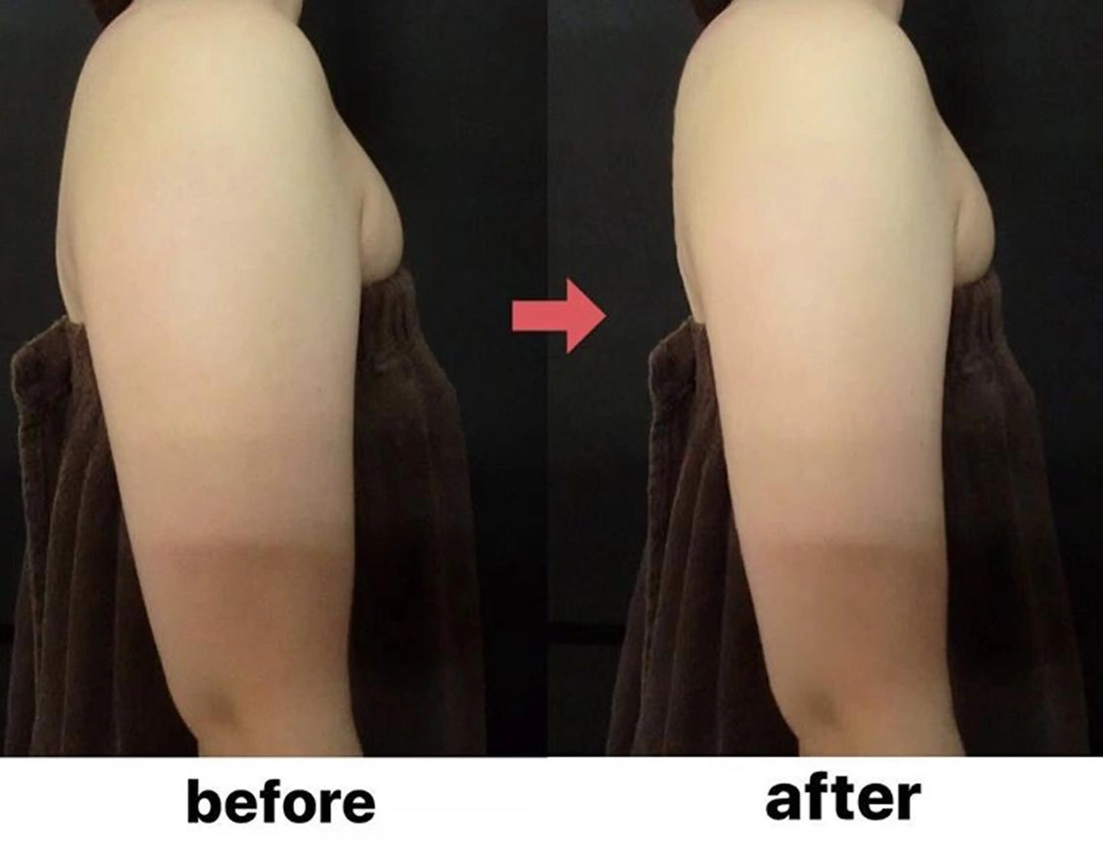 横浜エステサロン R-ing リングのエステ・リラクイメージ