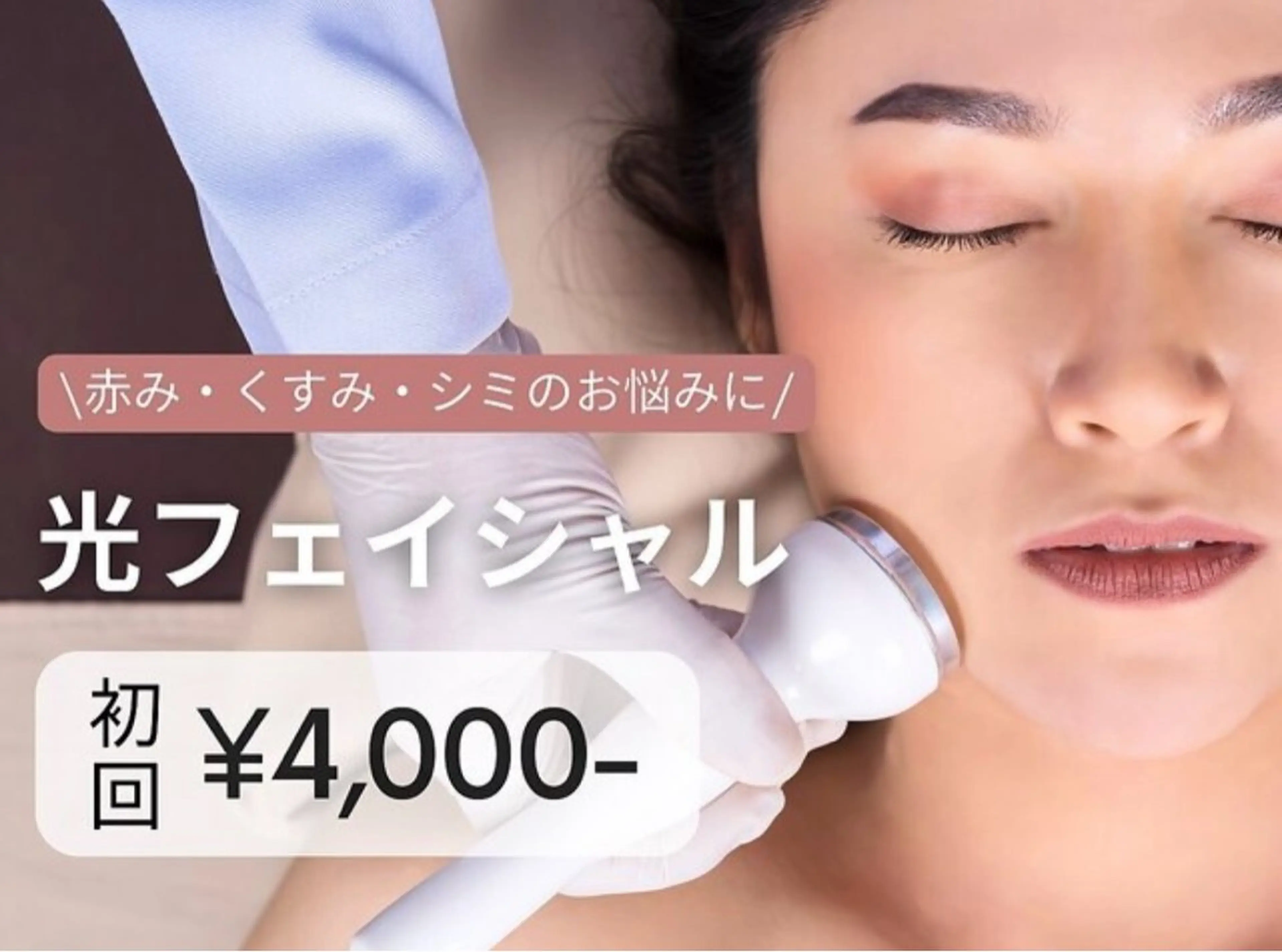 【限定価格★モテ肌へ】美肌に導く光フェイシャル 初回6000円→4000円の写真