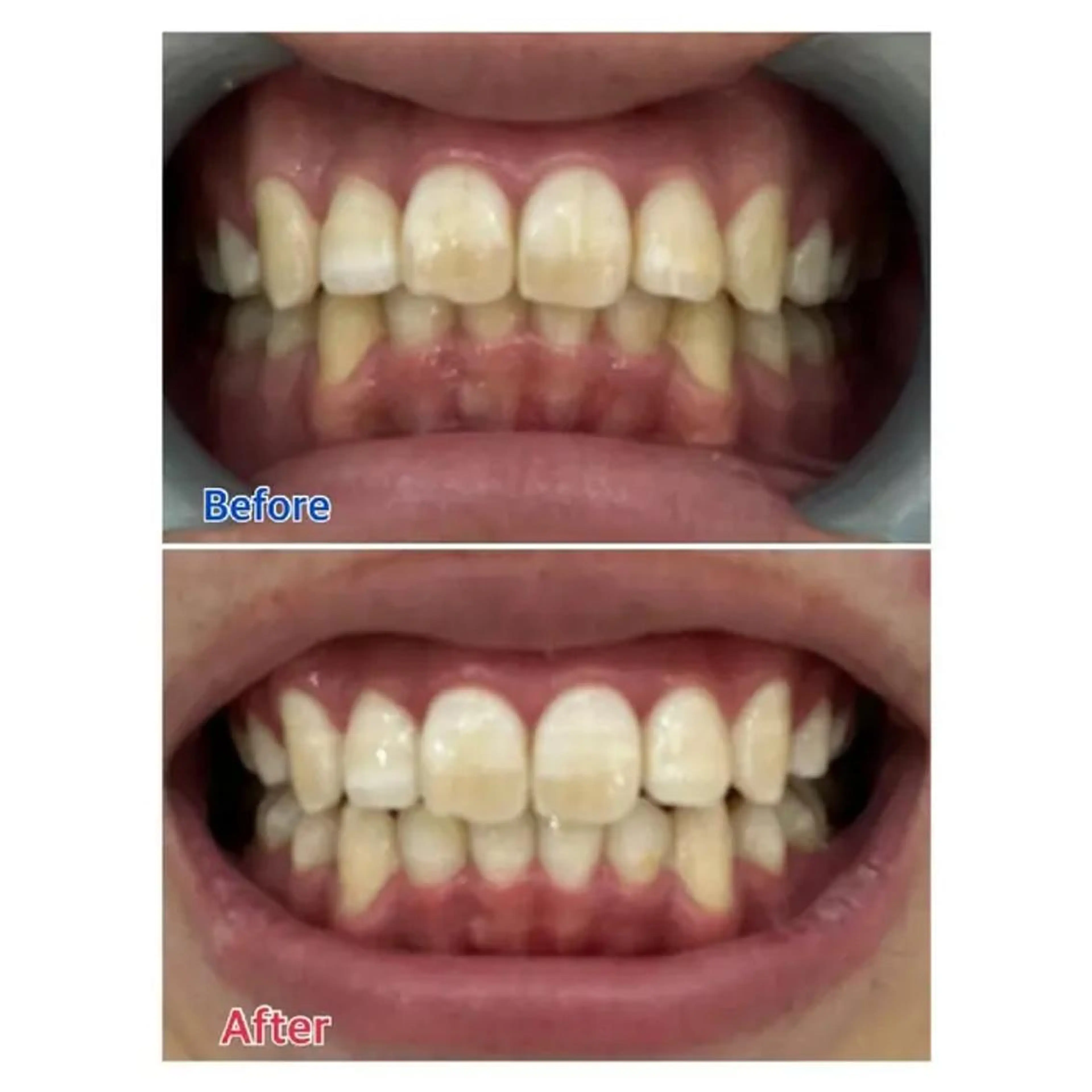 M渋谷 ホワイトニングのエステ・リラクイメージ