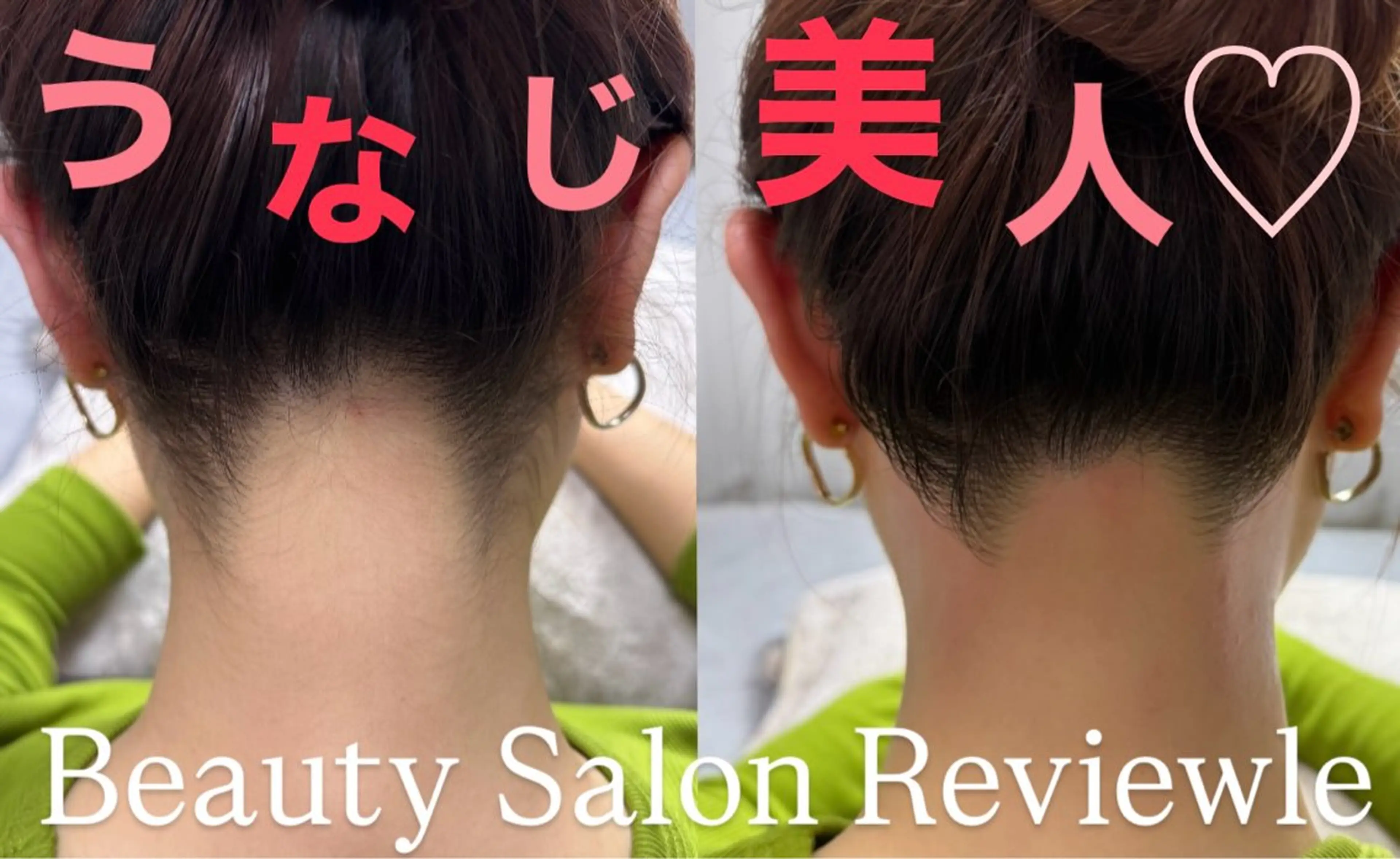 【うなじミックス脱毛】♡WAX+光♡うなじ→襟足→首までワックス+光脱毛♡鎮静クリーム付♩の写真
