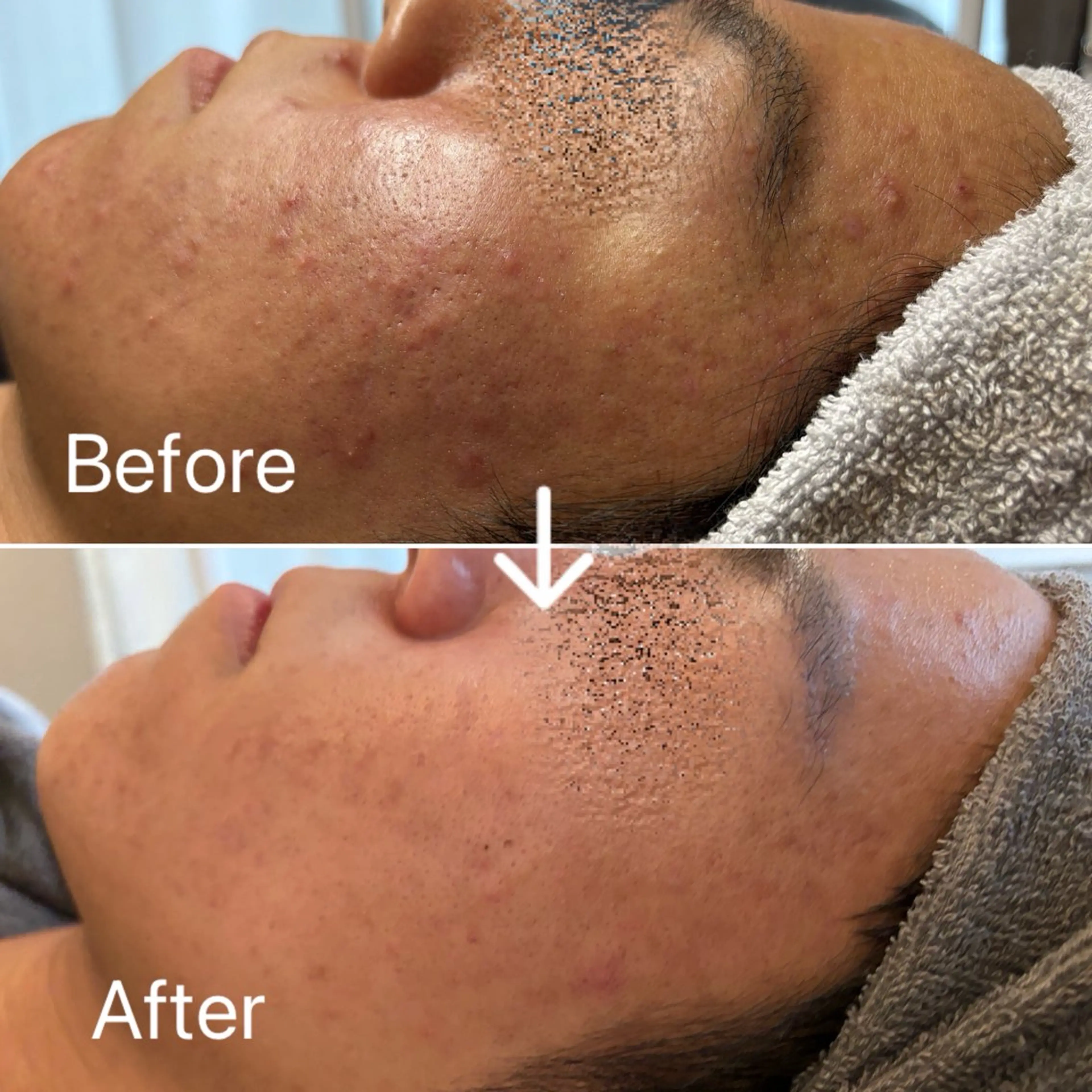 Blue Moon 【ブルームーン】のエステ・リラクイメージ