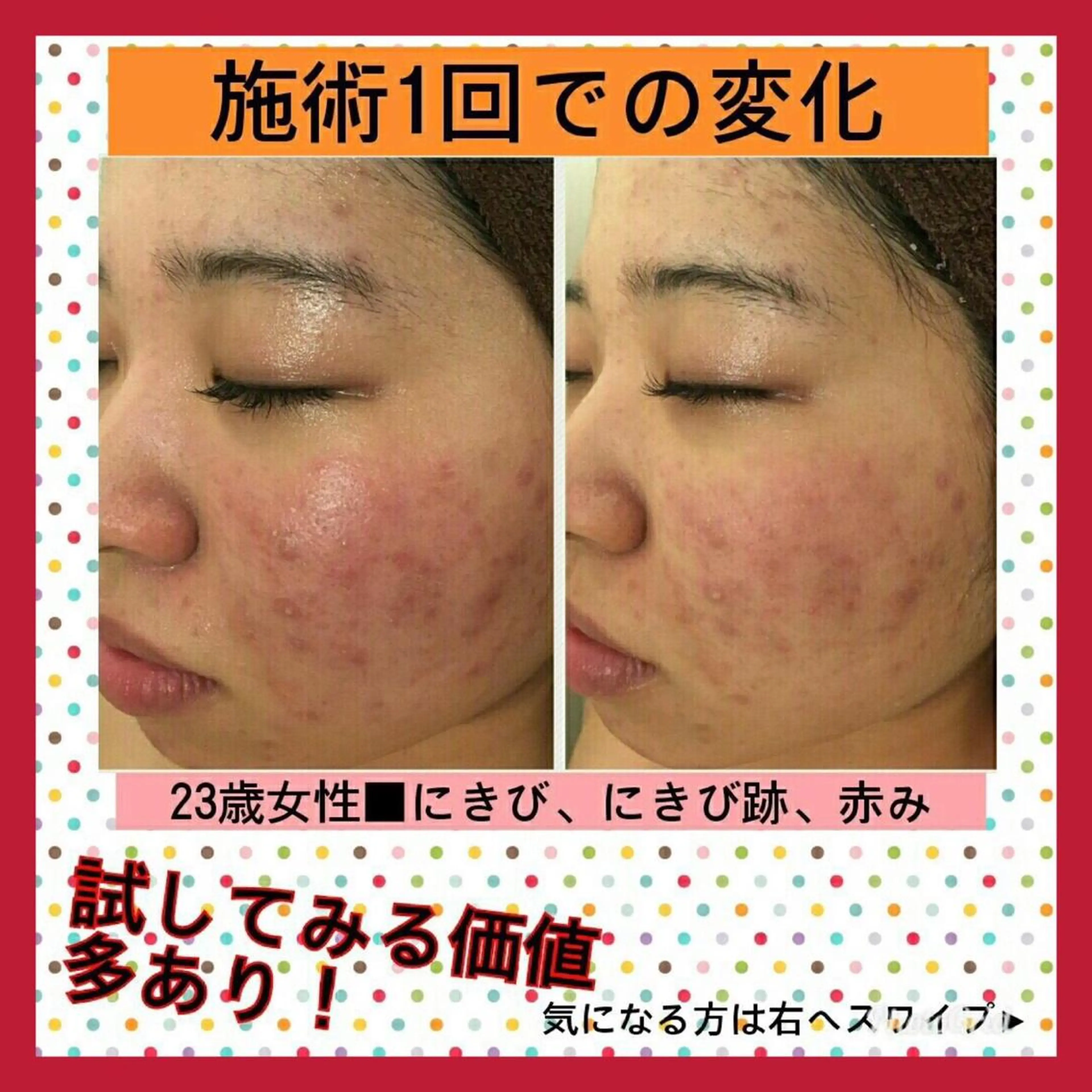 ミディアム パーマ ヘアアレンジ メンズ キッズ ネイル マツエク・マツパ エステ リラク ニキビ・肌質改善専門 ♡人生が変わるサロンのエステ・リラクイメージ