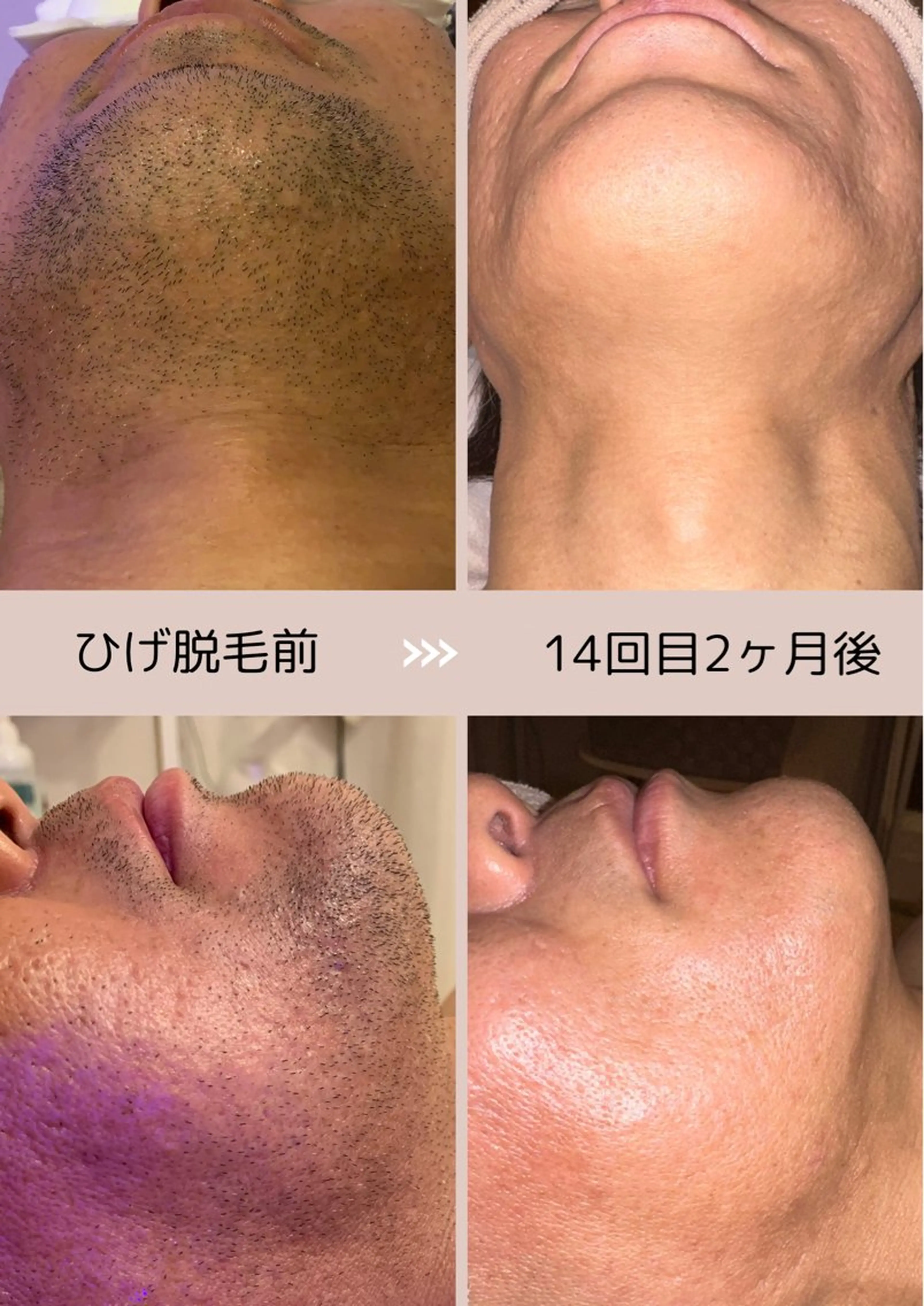 メンズ 脱毛 脱毛サロン Arumのエステ・リラクイメージ