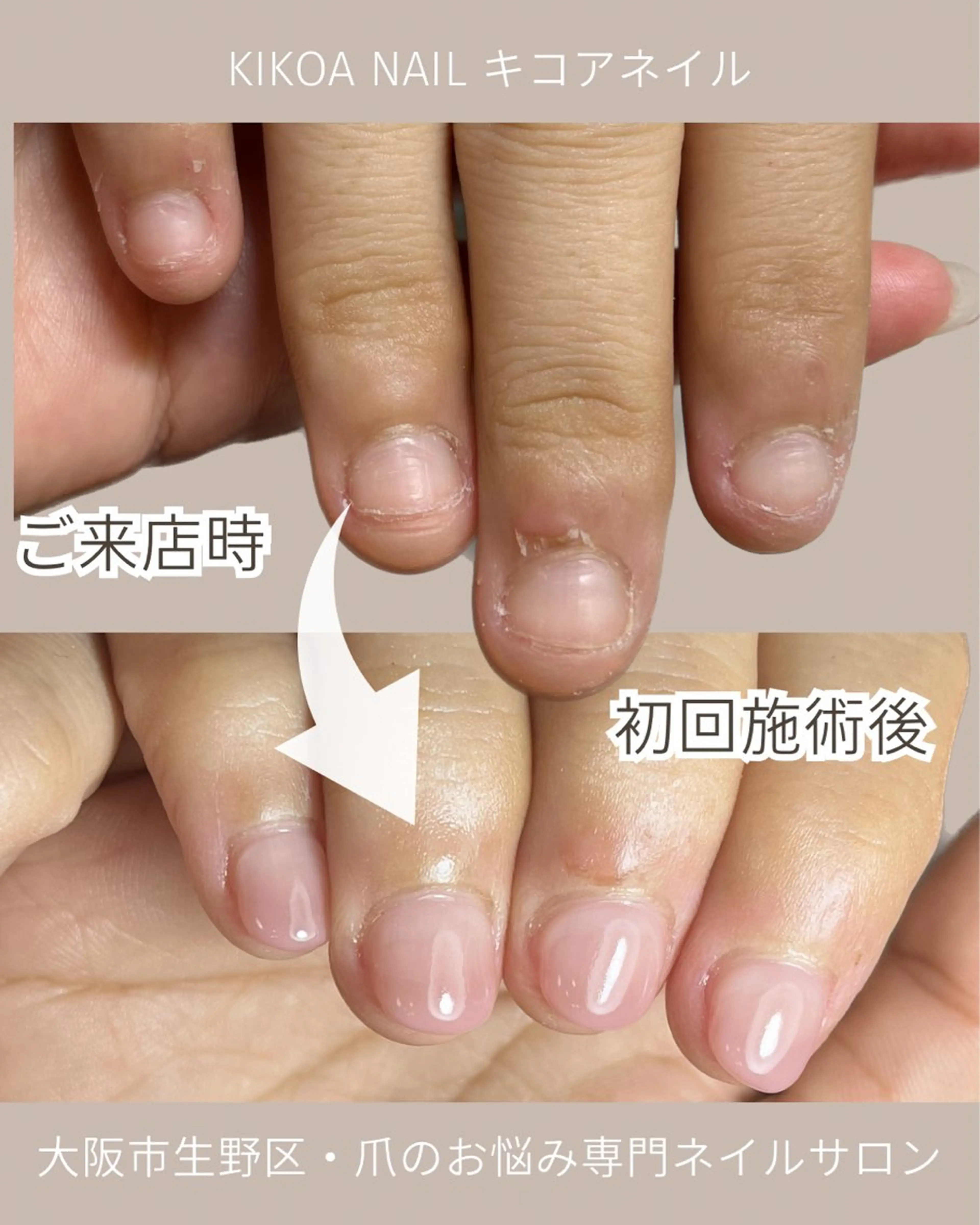 ネイル ピンク KIKOA NAIL キコアネイルのネイルデザイン
