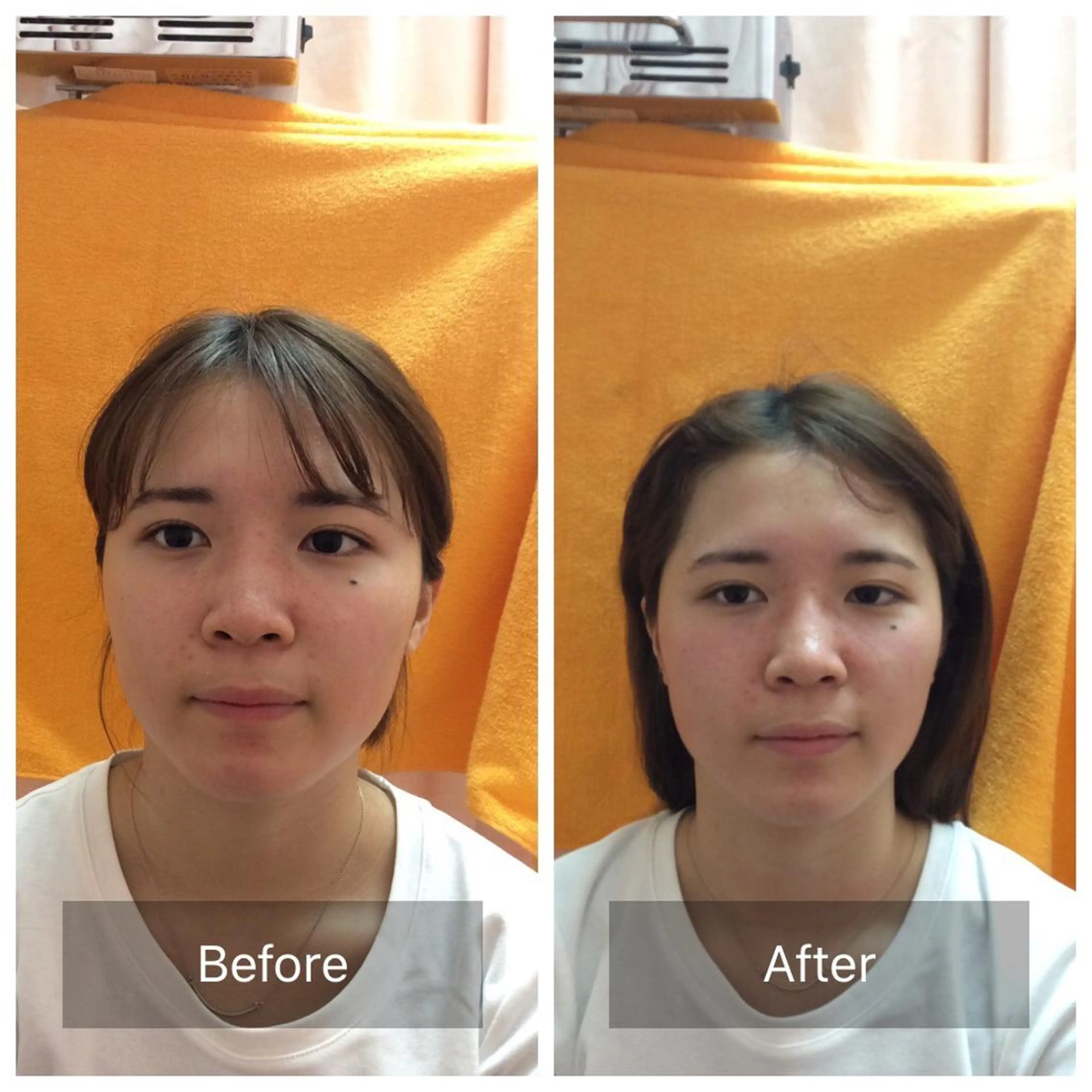 美容鍼×小顔矯正× 美容整体/小林幸司のエステ・リラクイメージ