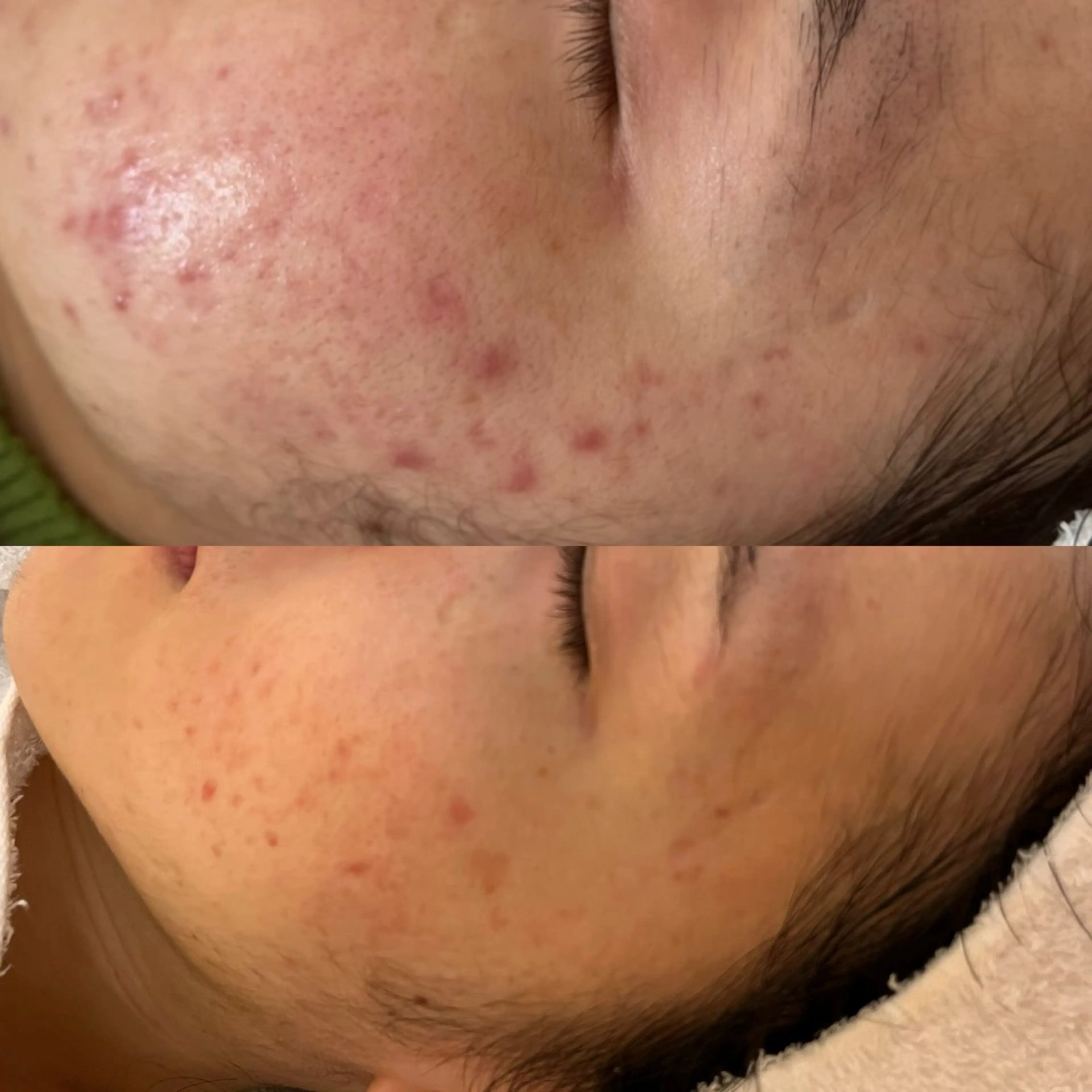 エステ リラク デアイム東広島所属・中井 小春のエステ・リラクイメージ