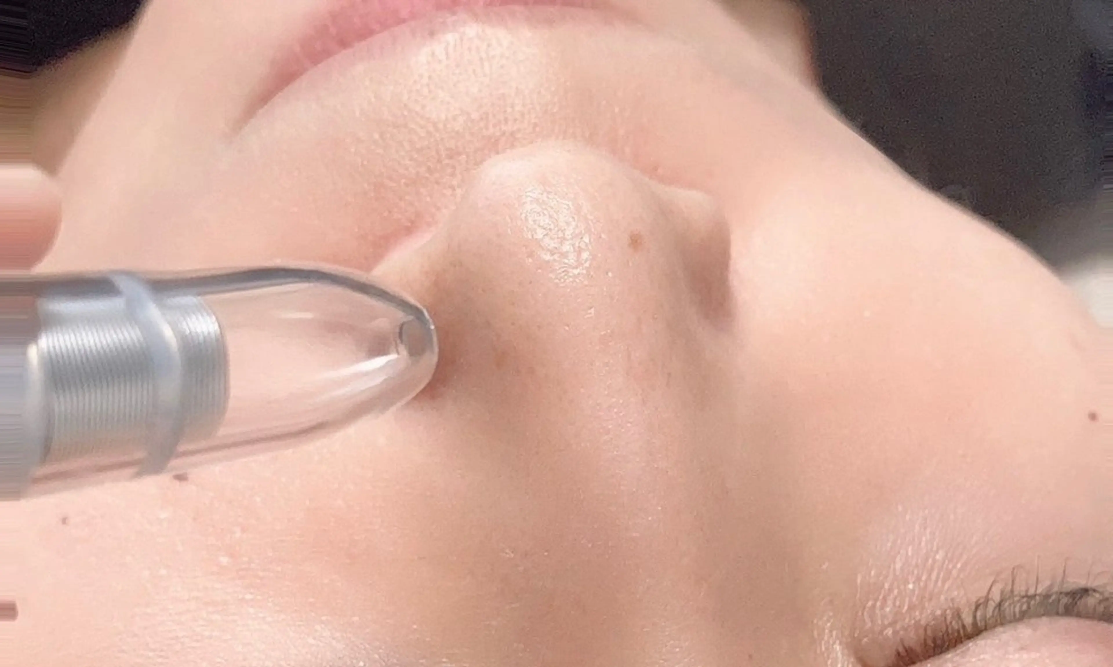 Beryl(ベリル)金町店所属・Beryl 金町店のエステ・リラクイメージ