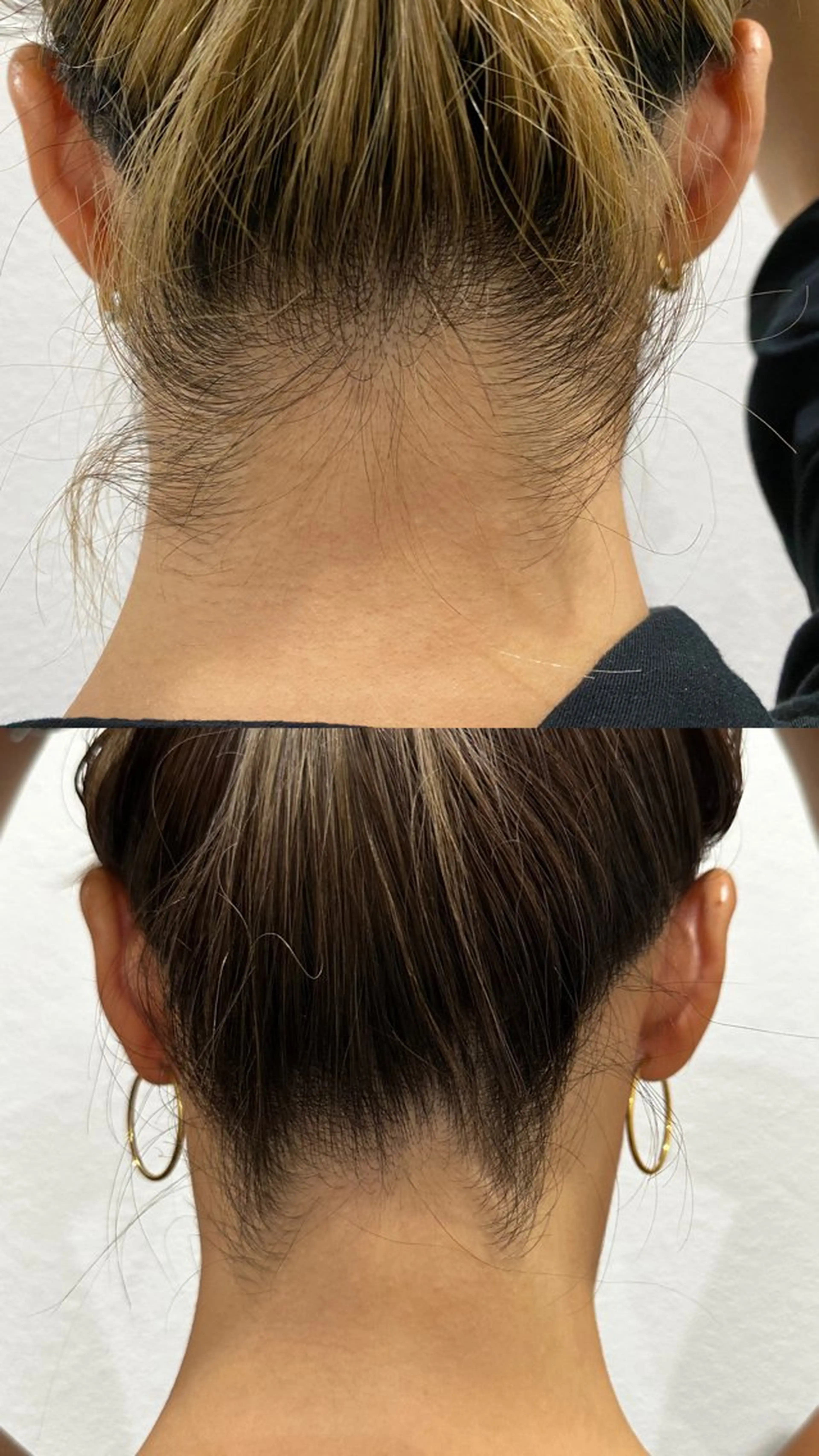 脱毛 パーソナル脱毛GROOM所属・パーソナル脱毛 GROOMのエステ・リラクイメージ