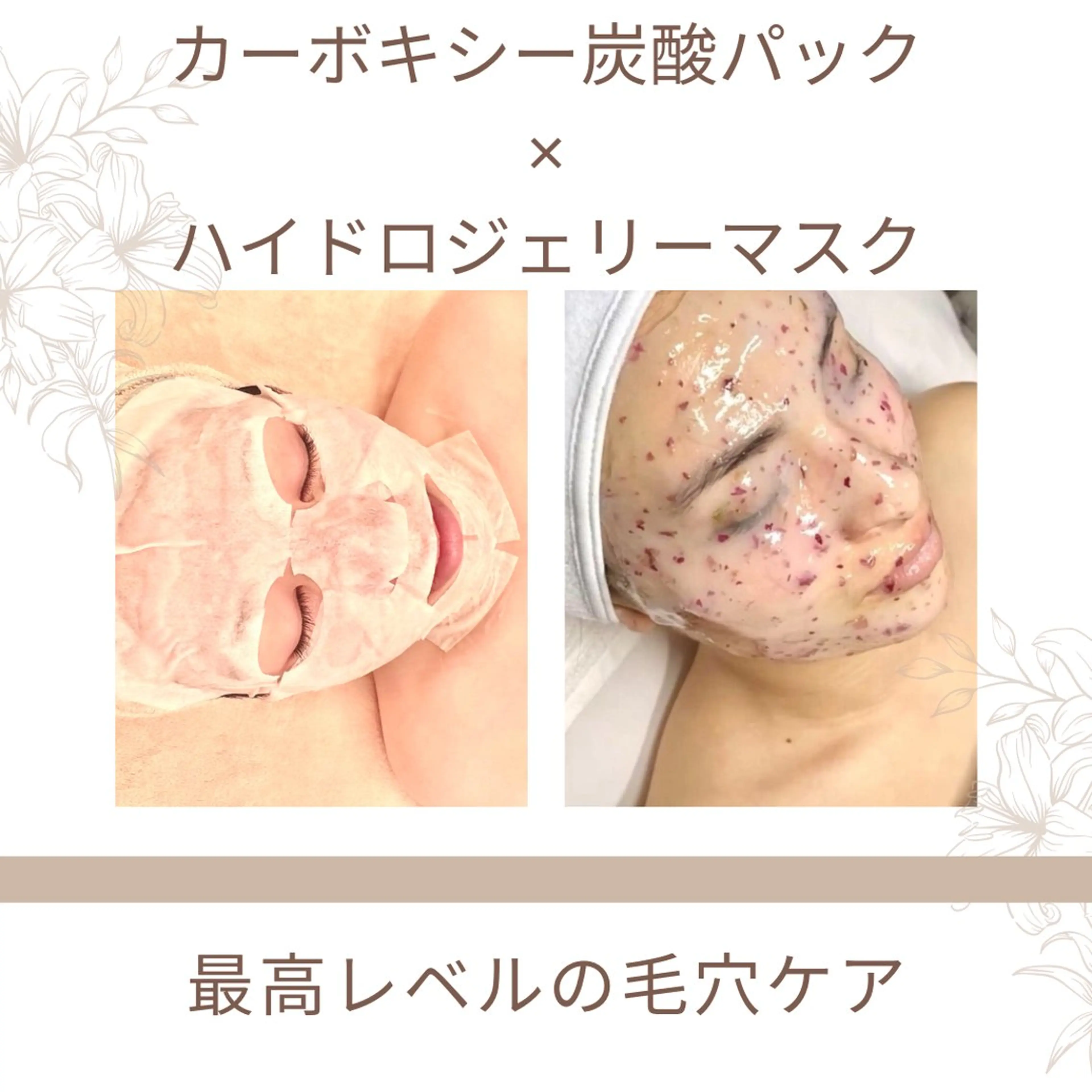 Lily luce 美骨小顔矯正のその他イメージ