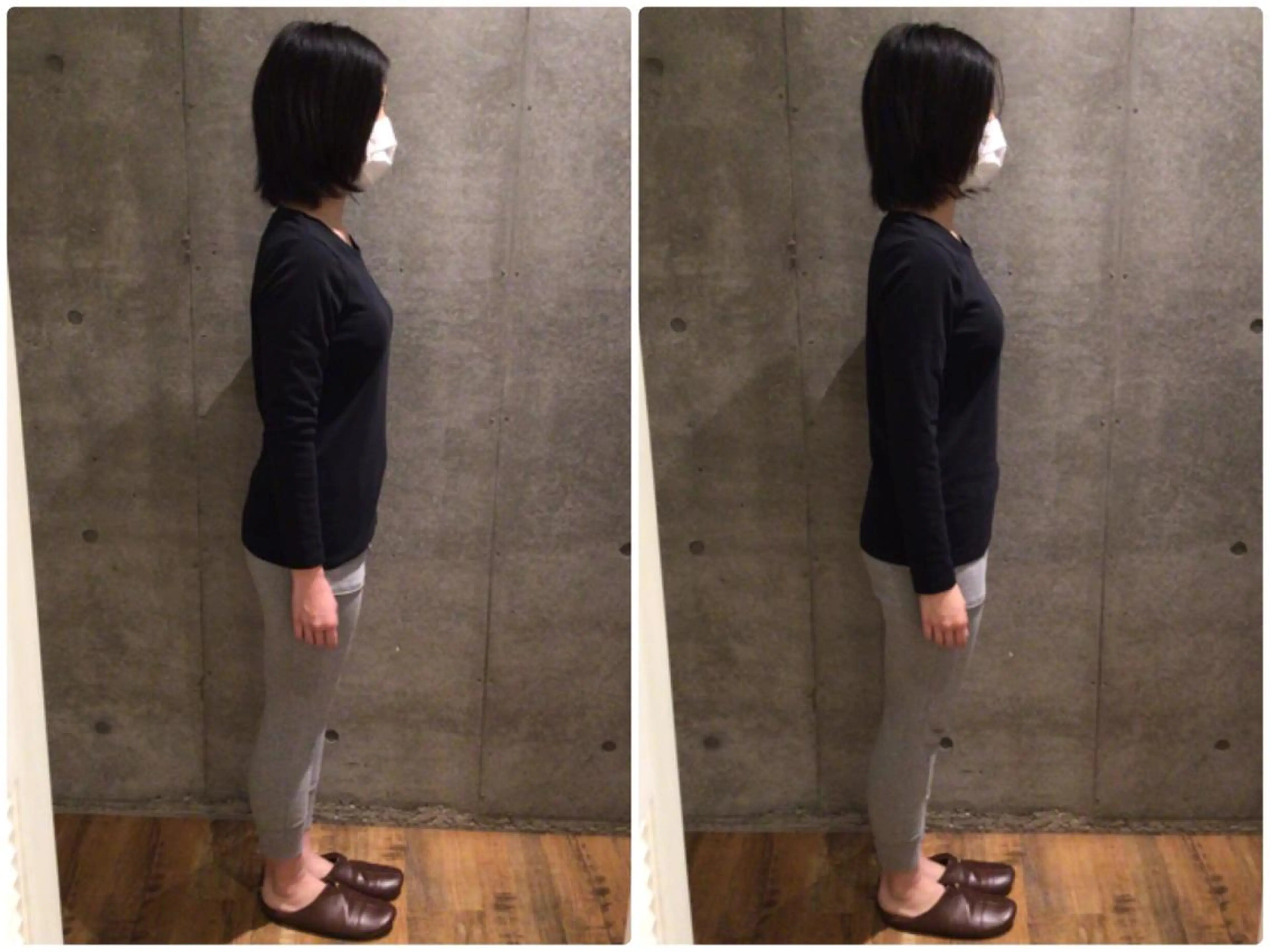 目黒/小顔/骨盤/ 美容鍼/美顔鍼/小林のエステ・リラクイメージ