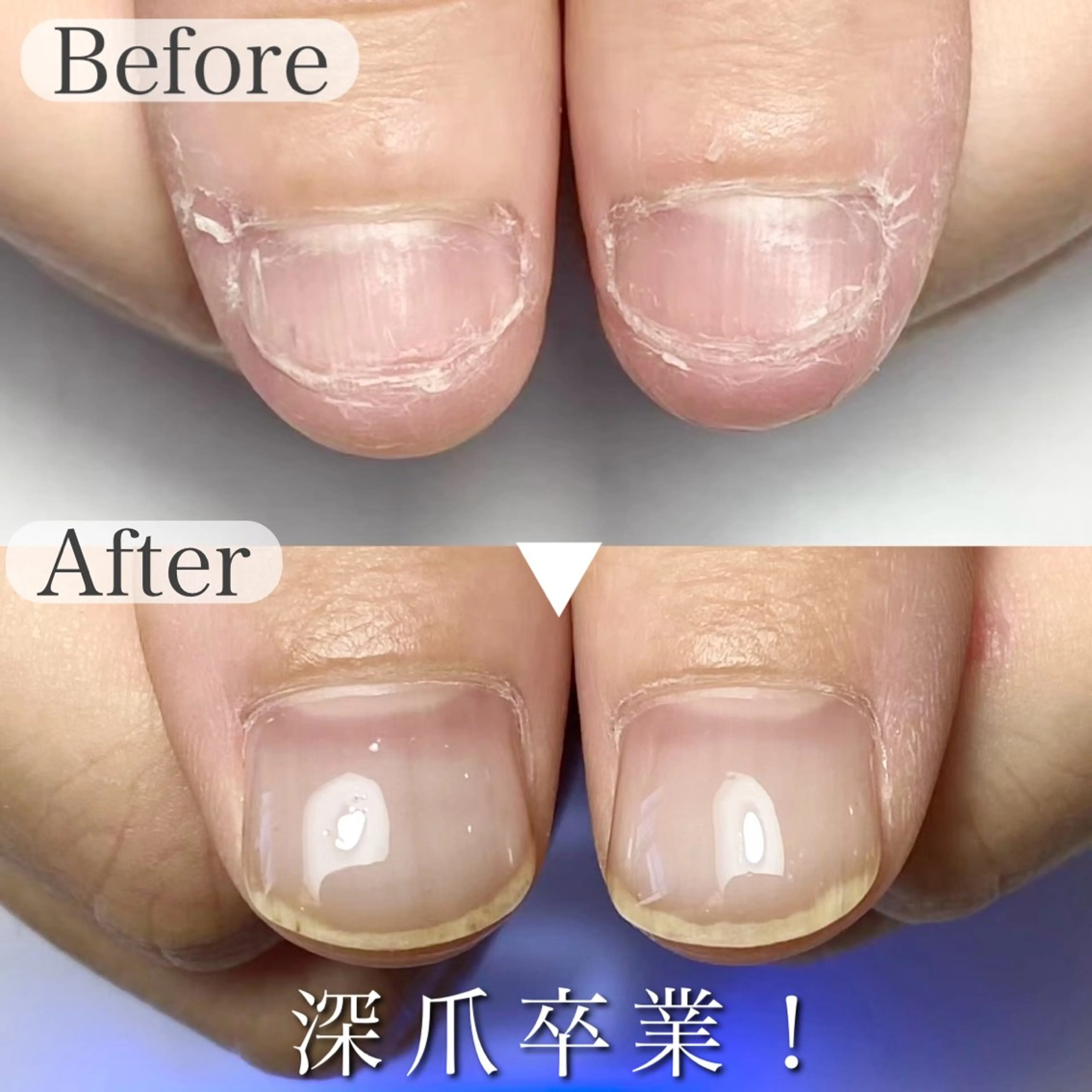 ネイル 深爪専門店 サロンリリーのネイルデザイン