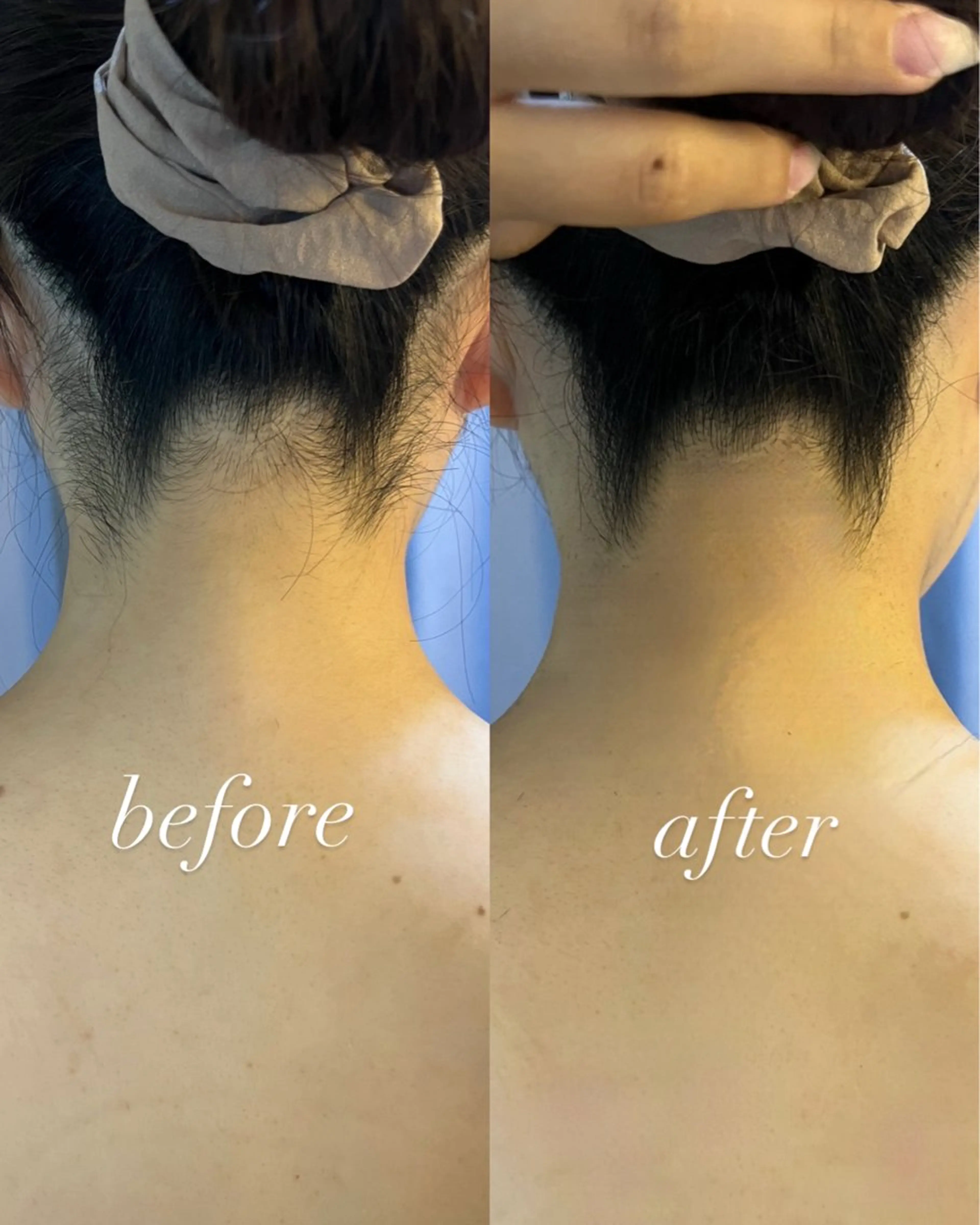 うなじ脱毛/美肌脱毛 LABELのエステ・リラクイメージ