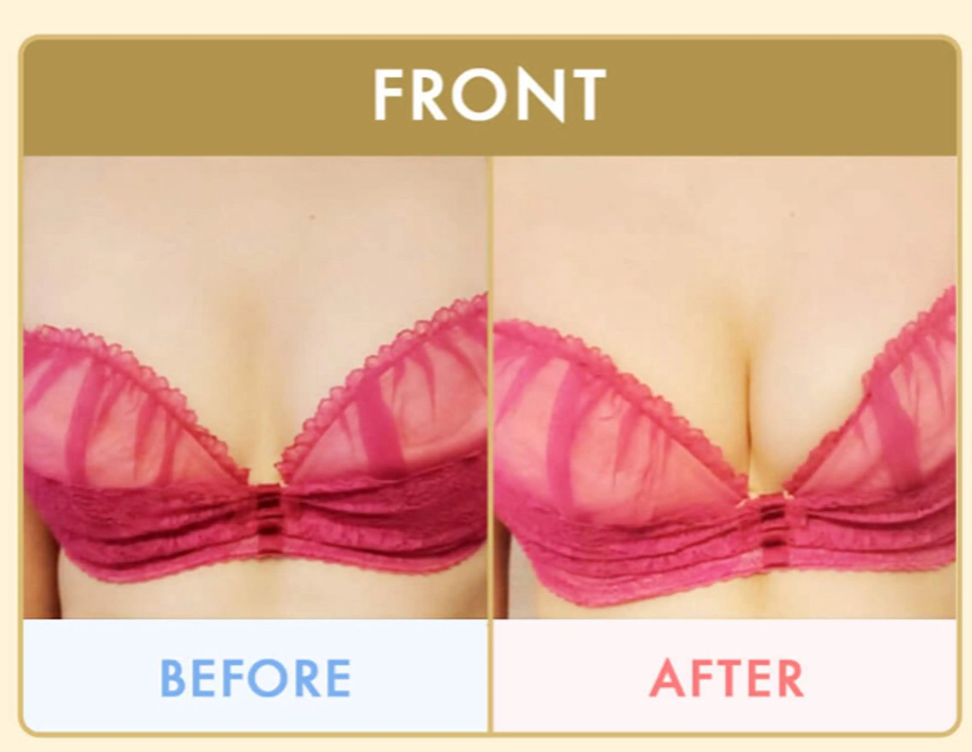 無人セルフ脱毛サロン MIRAE(ミレ)のエステ・リラクイメージ