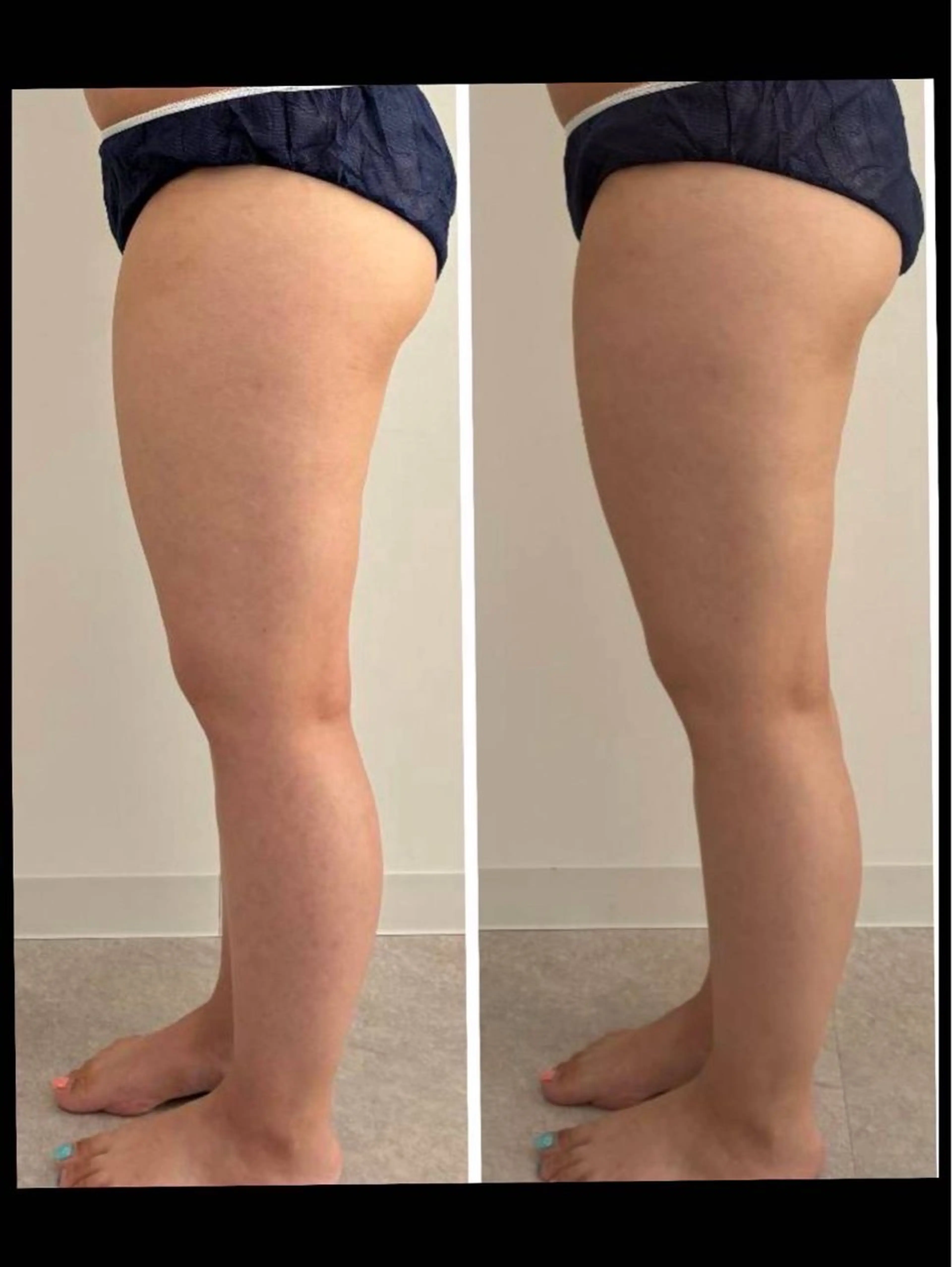 AZU 小林朋美のエステ・リラクイメージ