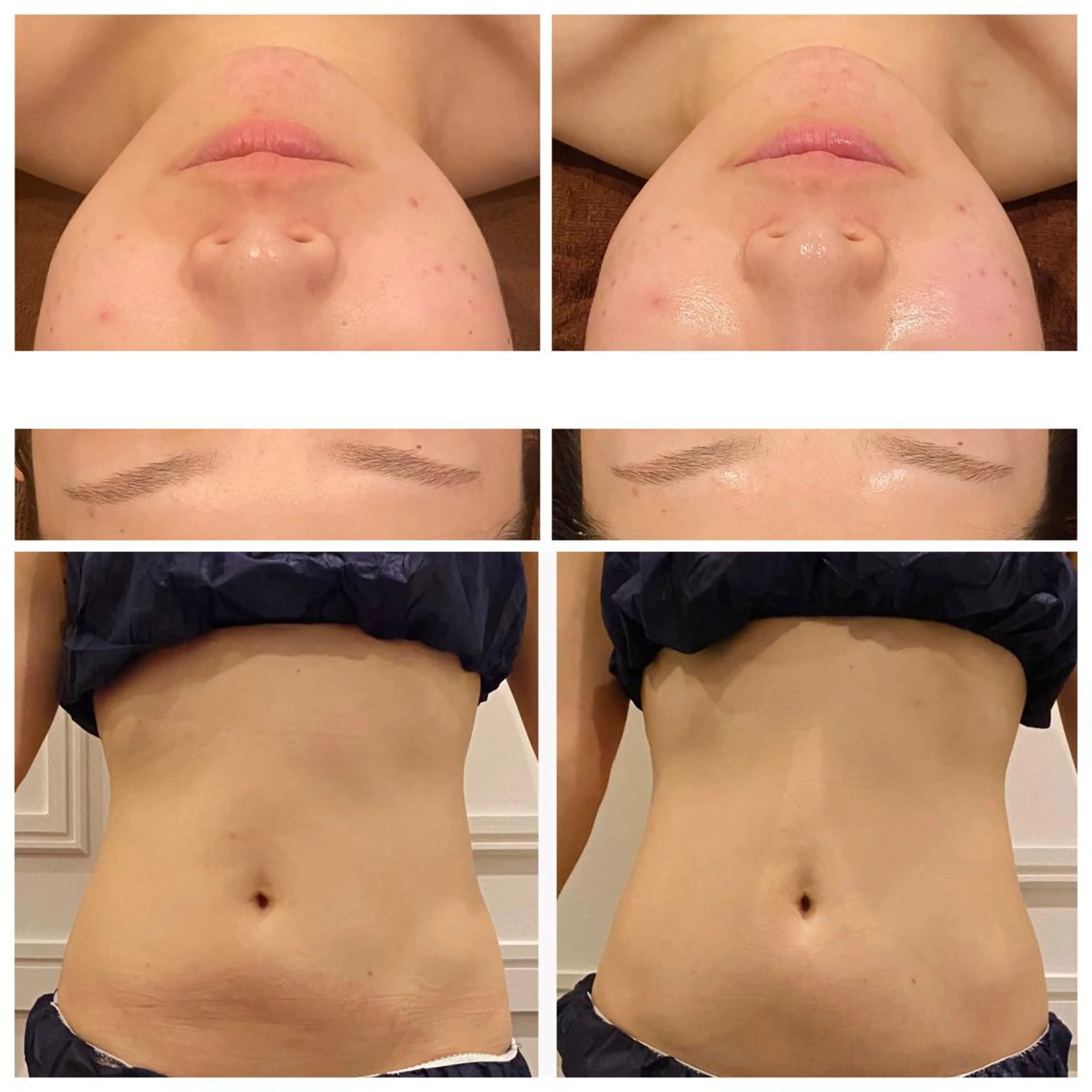 エステ 小顔EX心斎橋 REVIハーブのエステ・リラクイメージ