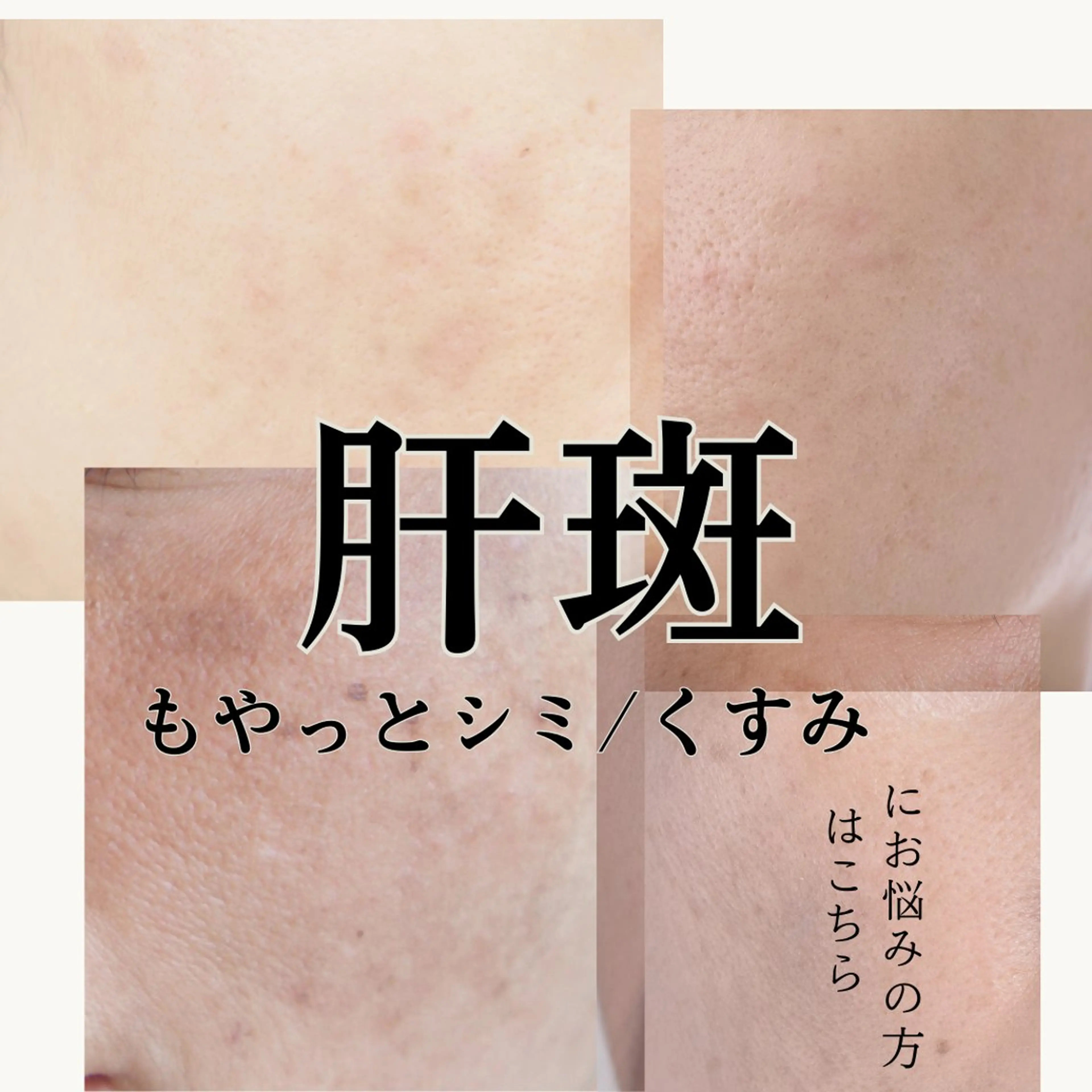 稲垣 優のエステ・リラクイメージ