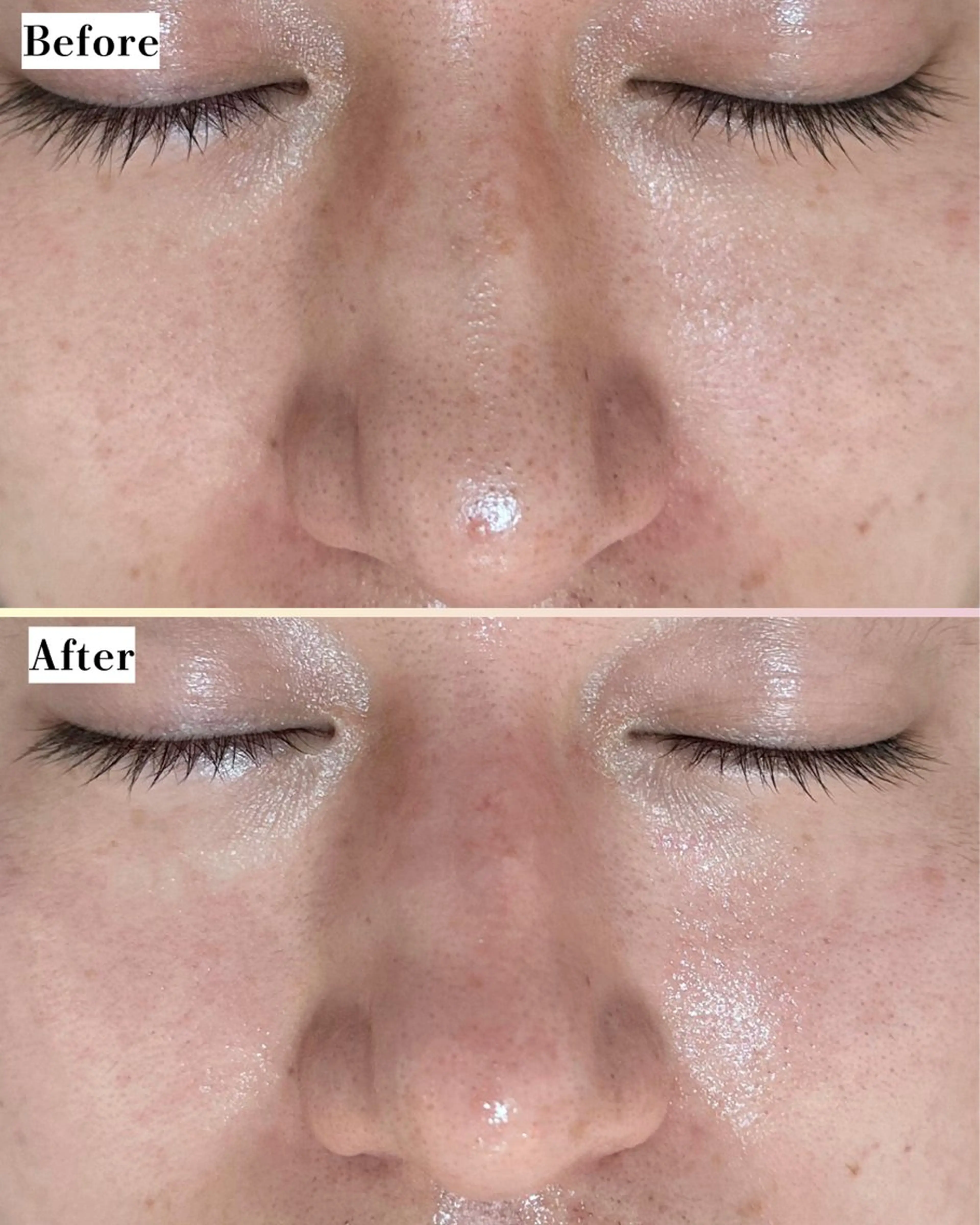 エステ |ピーリング・毛穴| soina神楽坂のエステ・リラクイメージ