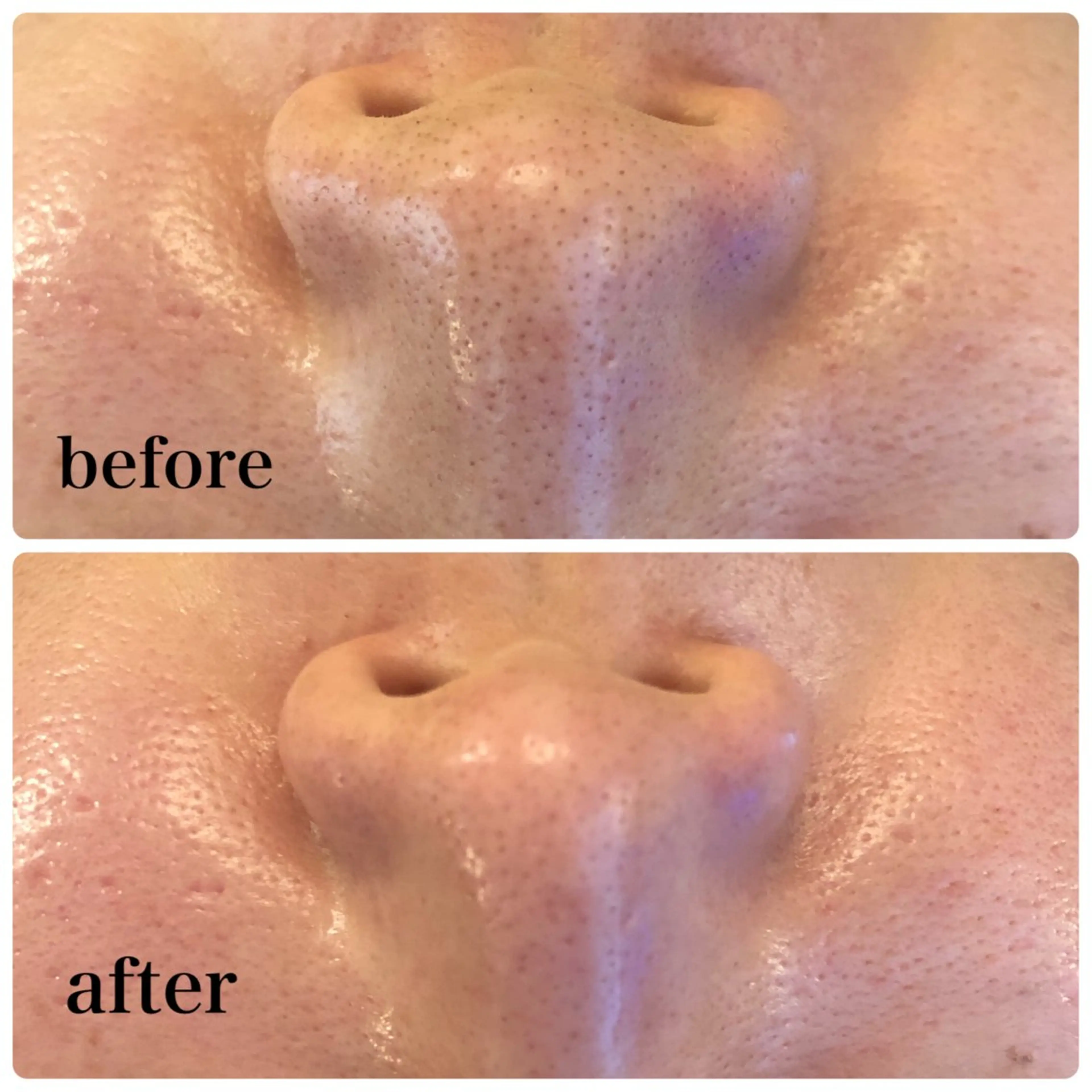 毛穴のお悩み・シミ 松本瞳のエステ・リラクイメージ