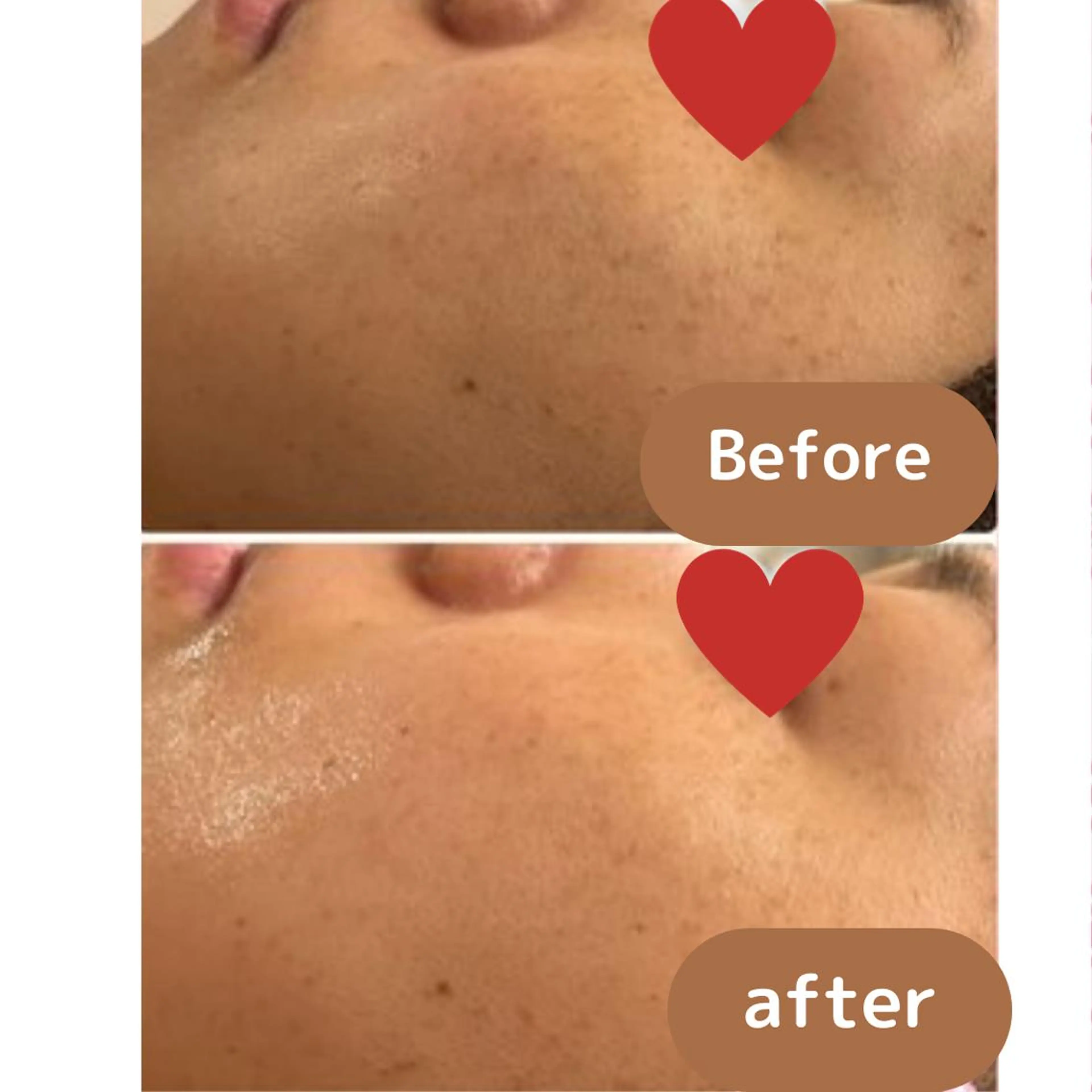 TWINKLE上尾店 Shimadaのエステ・リラクイメージ