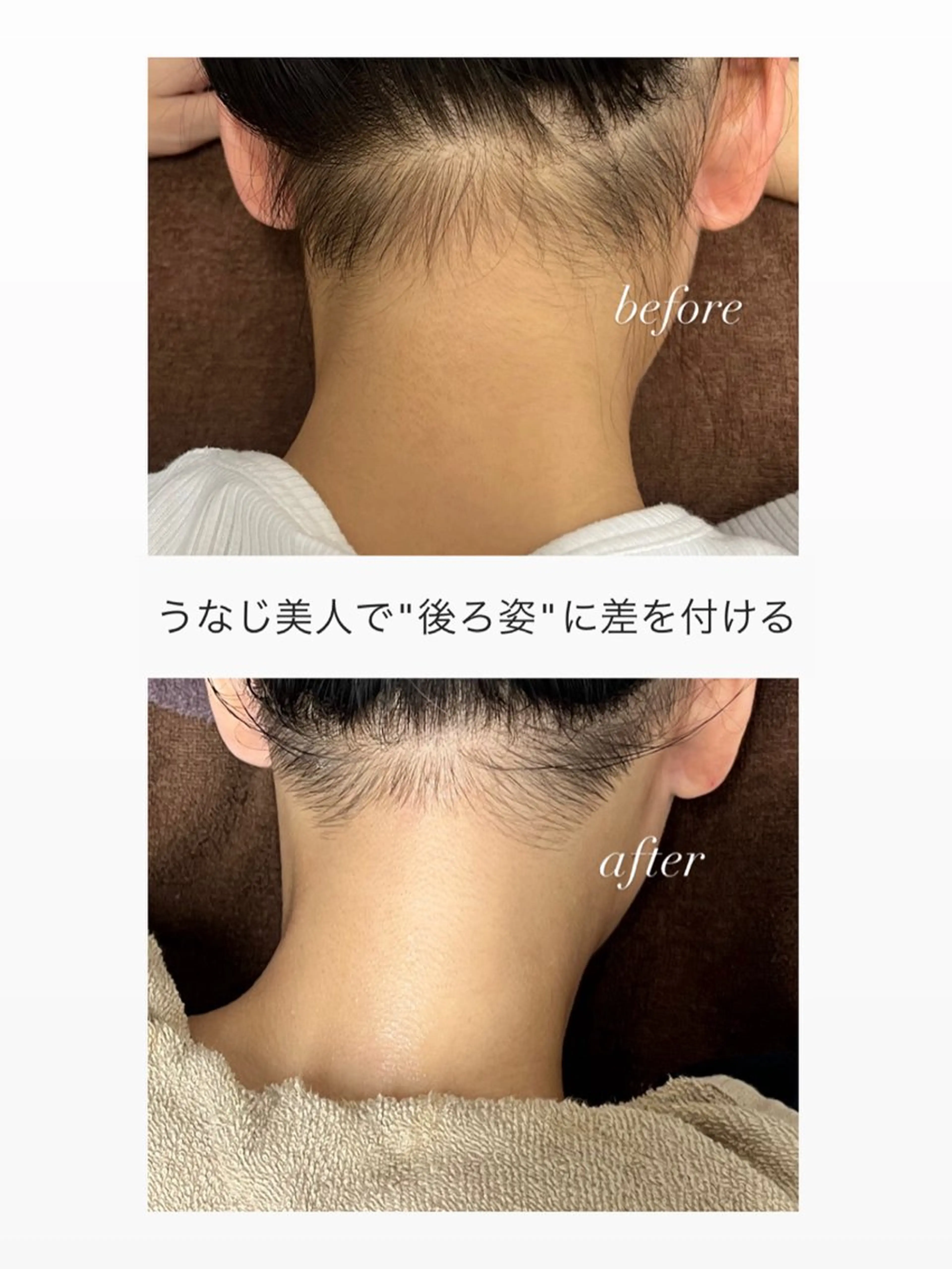 脱毛 smileskin 京都／meguのその他イメージ