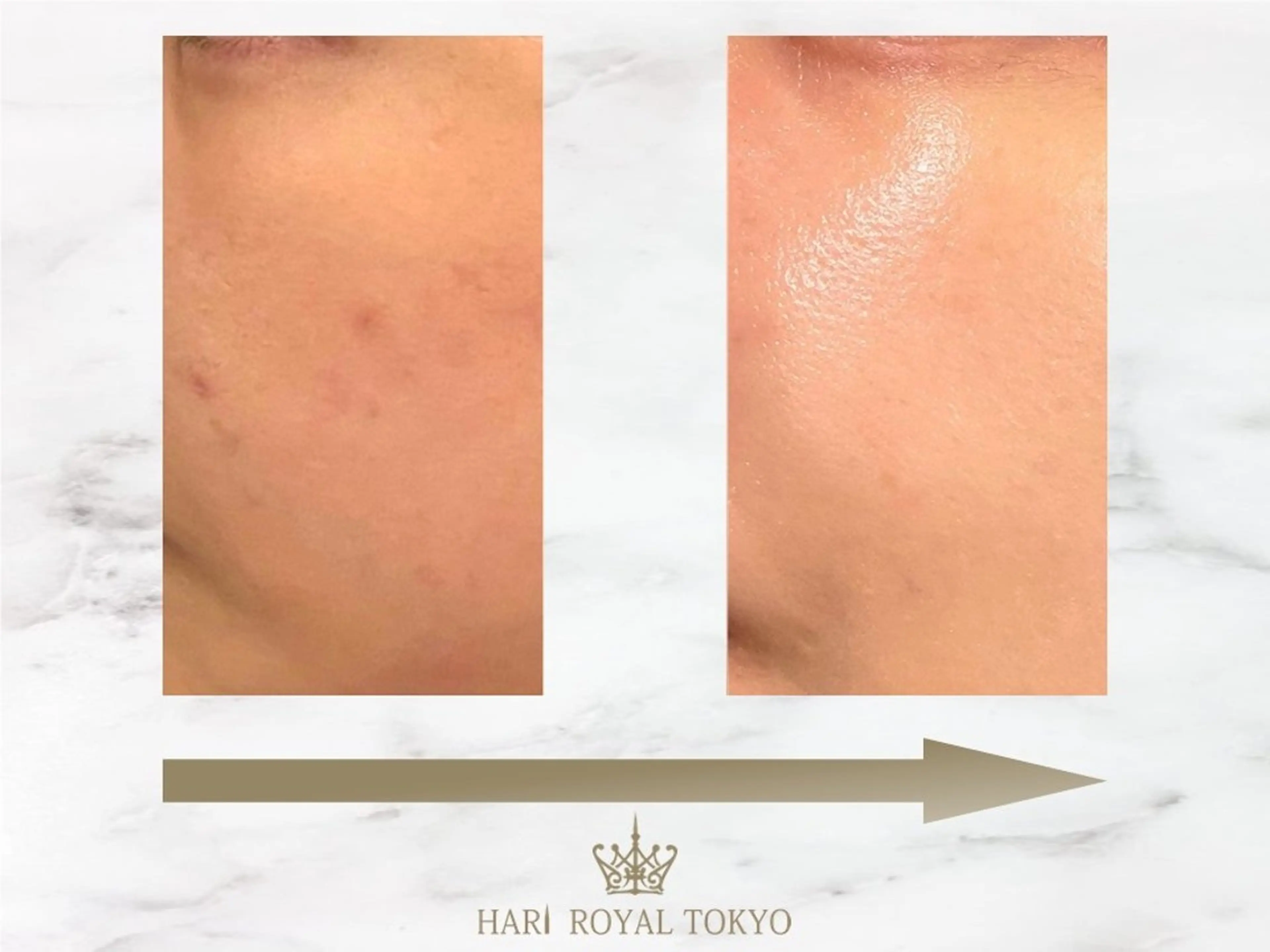 その他 ハリロイヤルトーキョー武蔵小山所属・ニューハーフ鍼灸師 🖤🤍Saya🌹のエステ・リラクイメージ