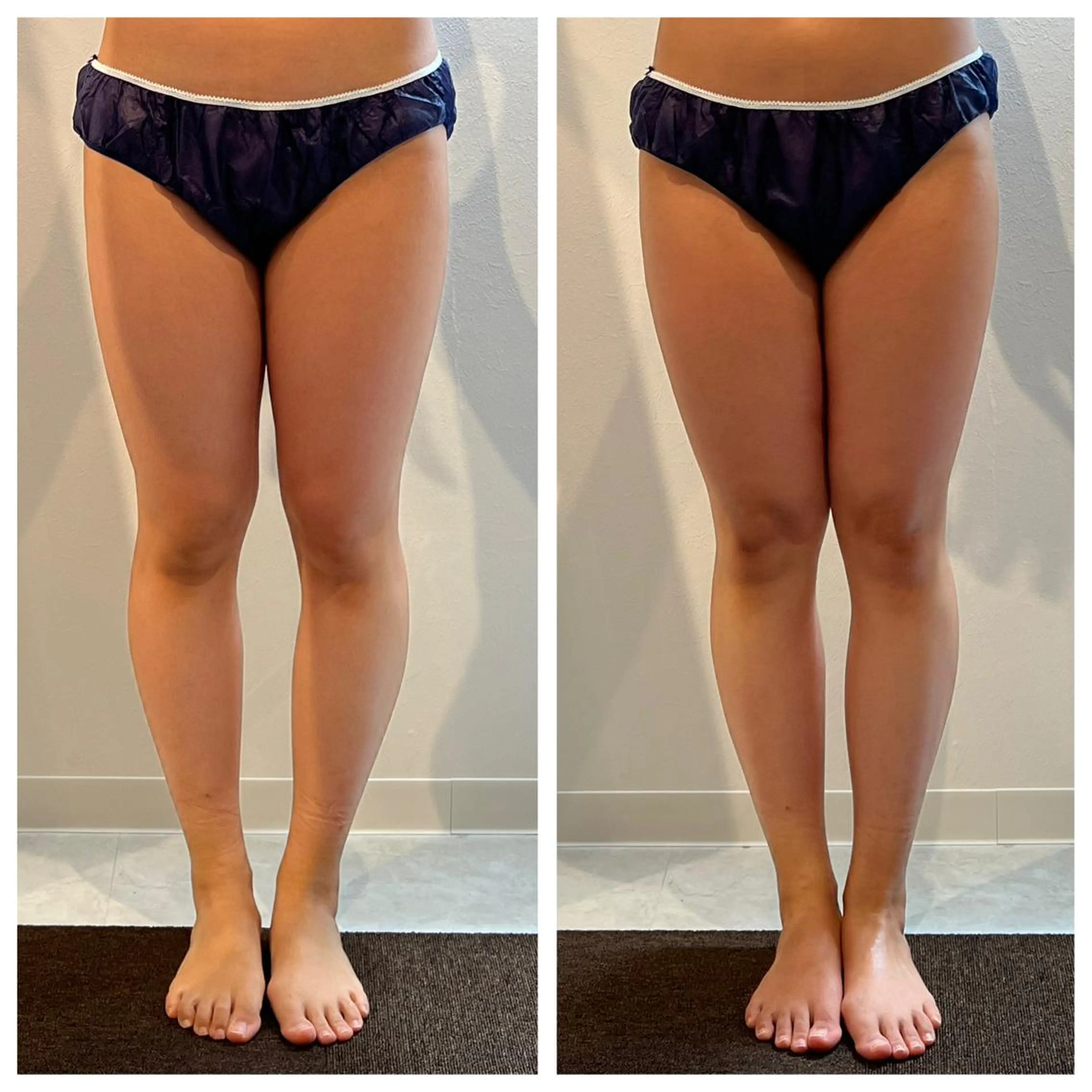 Reveur REMIのエステ・リラクイメージ