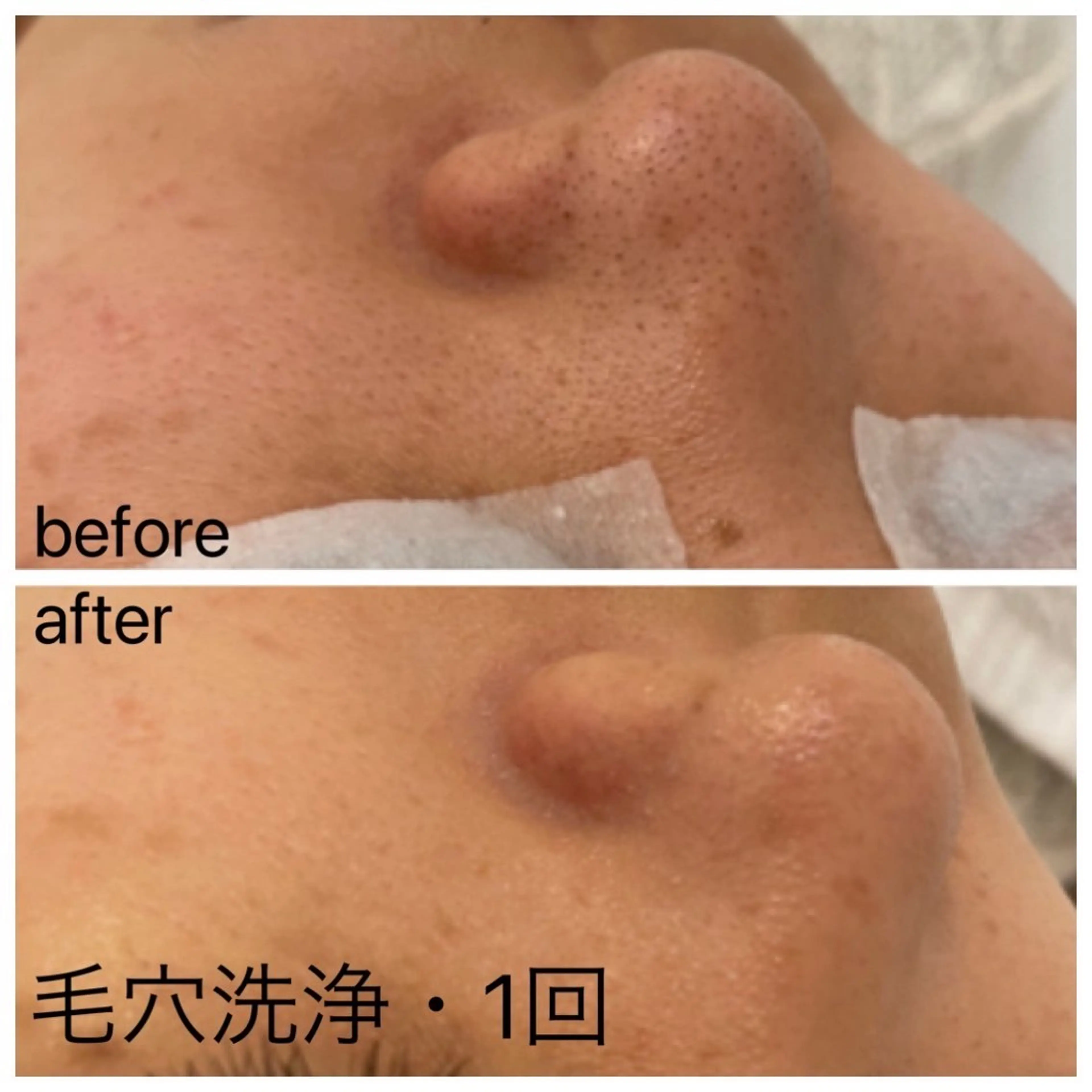 痛くない美肌脱毛 AZALEA本厚木店のエステ・リラクイメージ