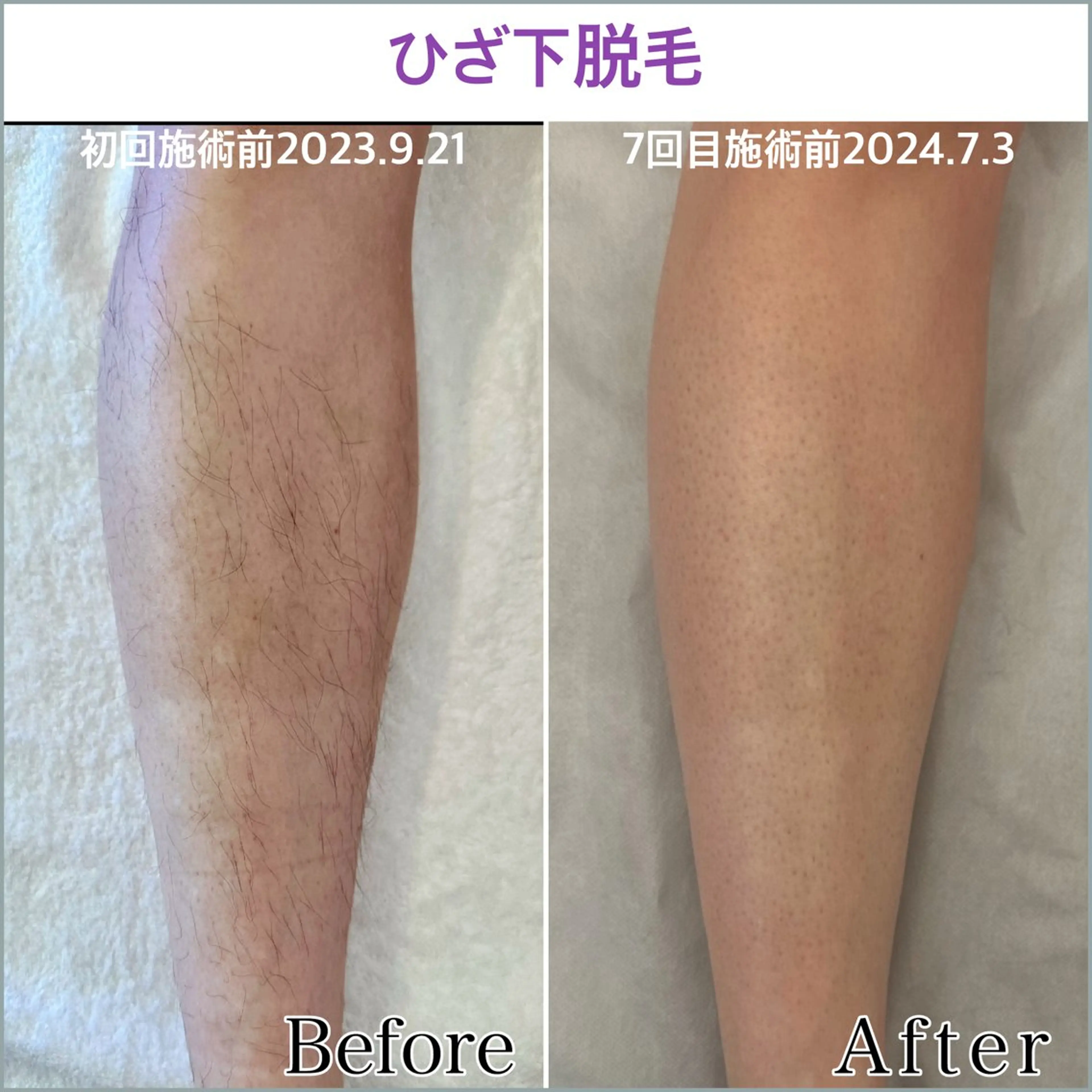 プライベートサロン エル〜aile～のエステ・リラクイメージ