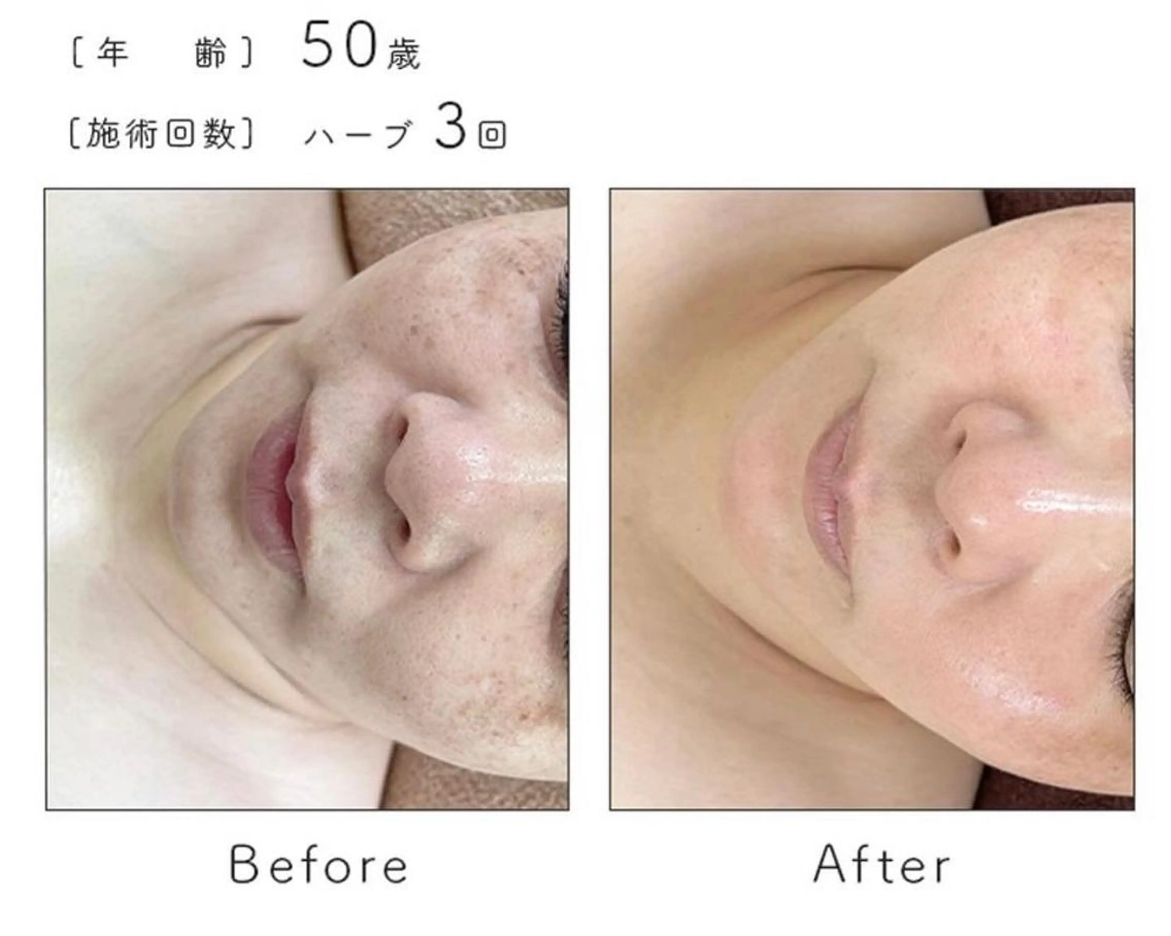 エステ ハーブピーリング専門 BIOPLUS＋川崎のエステ・リラクイメージ