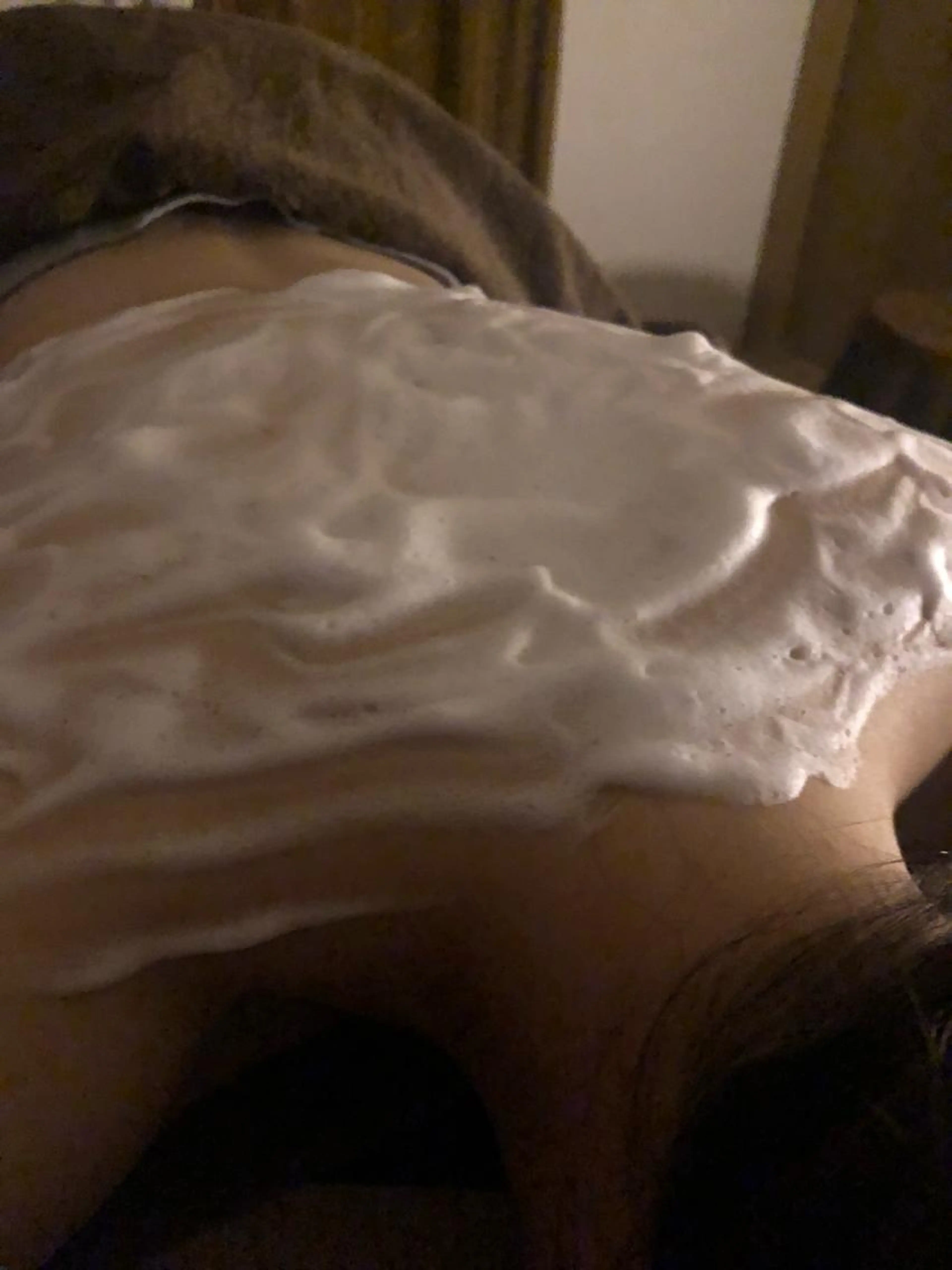 【ご新規様】［ダウンタイムなし］背中ハーブピーリング🌿90分コースの写真