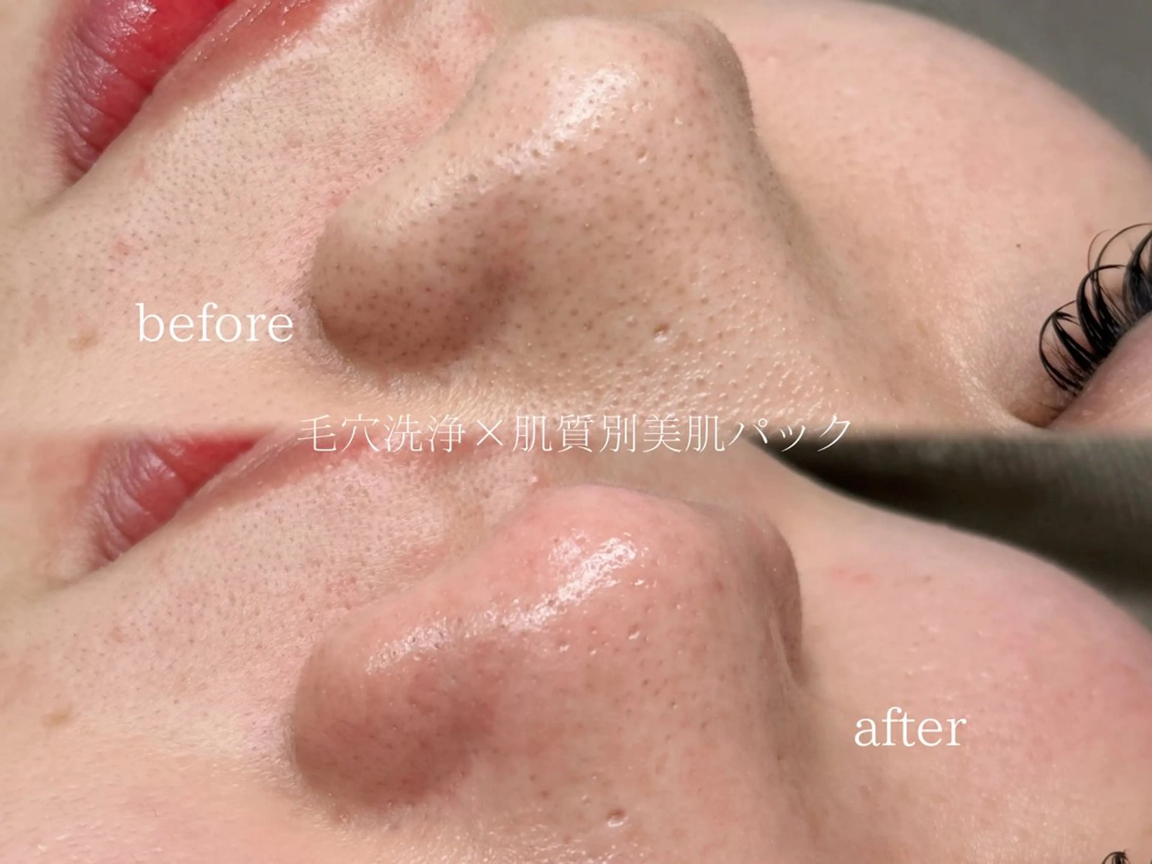 毛穴と脱毛のお店 "Lea" 壷林のエステ・リラクイメージ