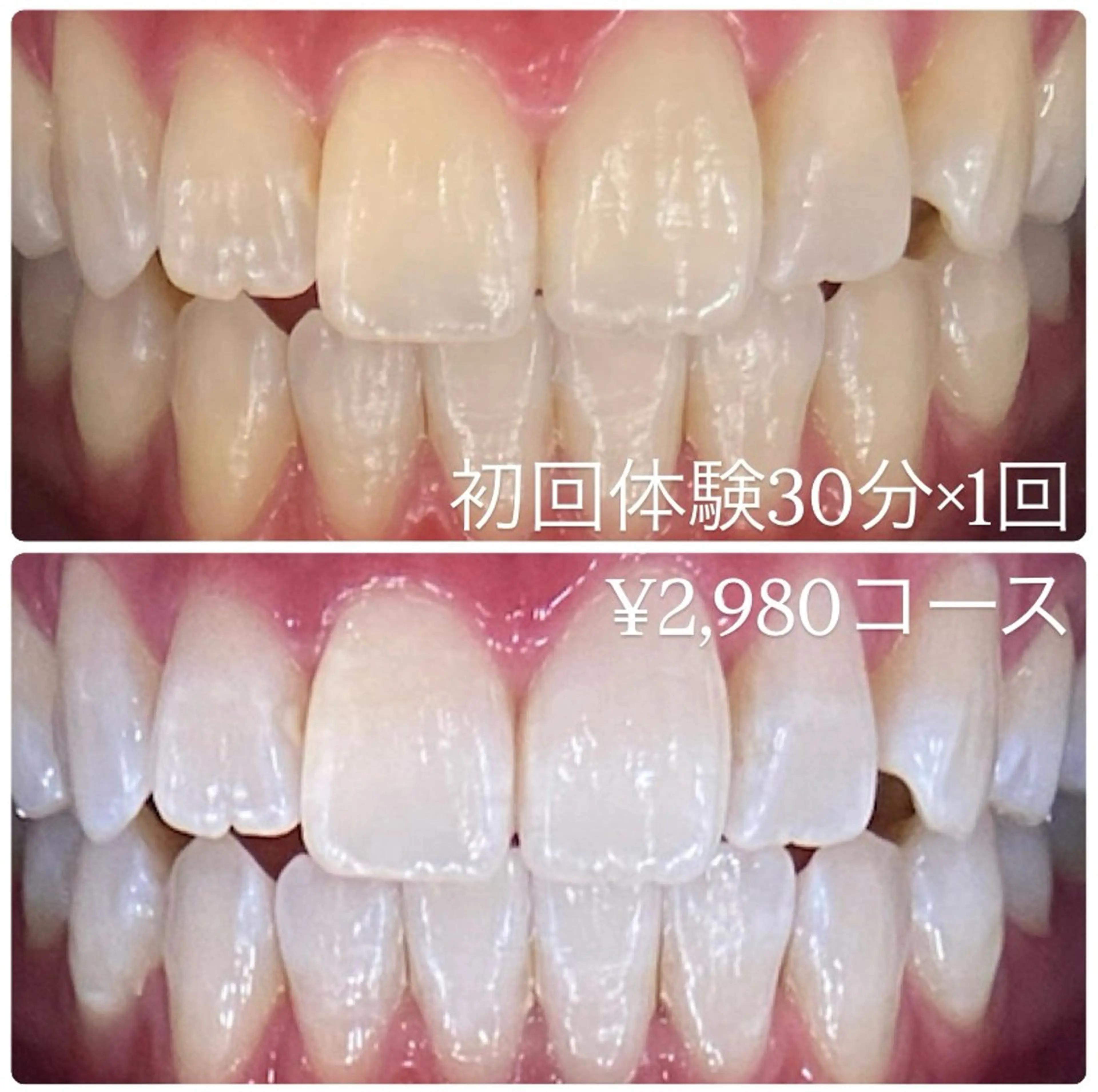 PLATINUM Beauty 横浜店所属・ホワイトニングルーム 横浜店のその他イメージ