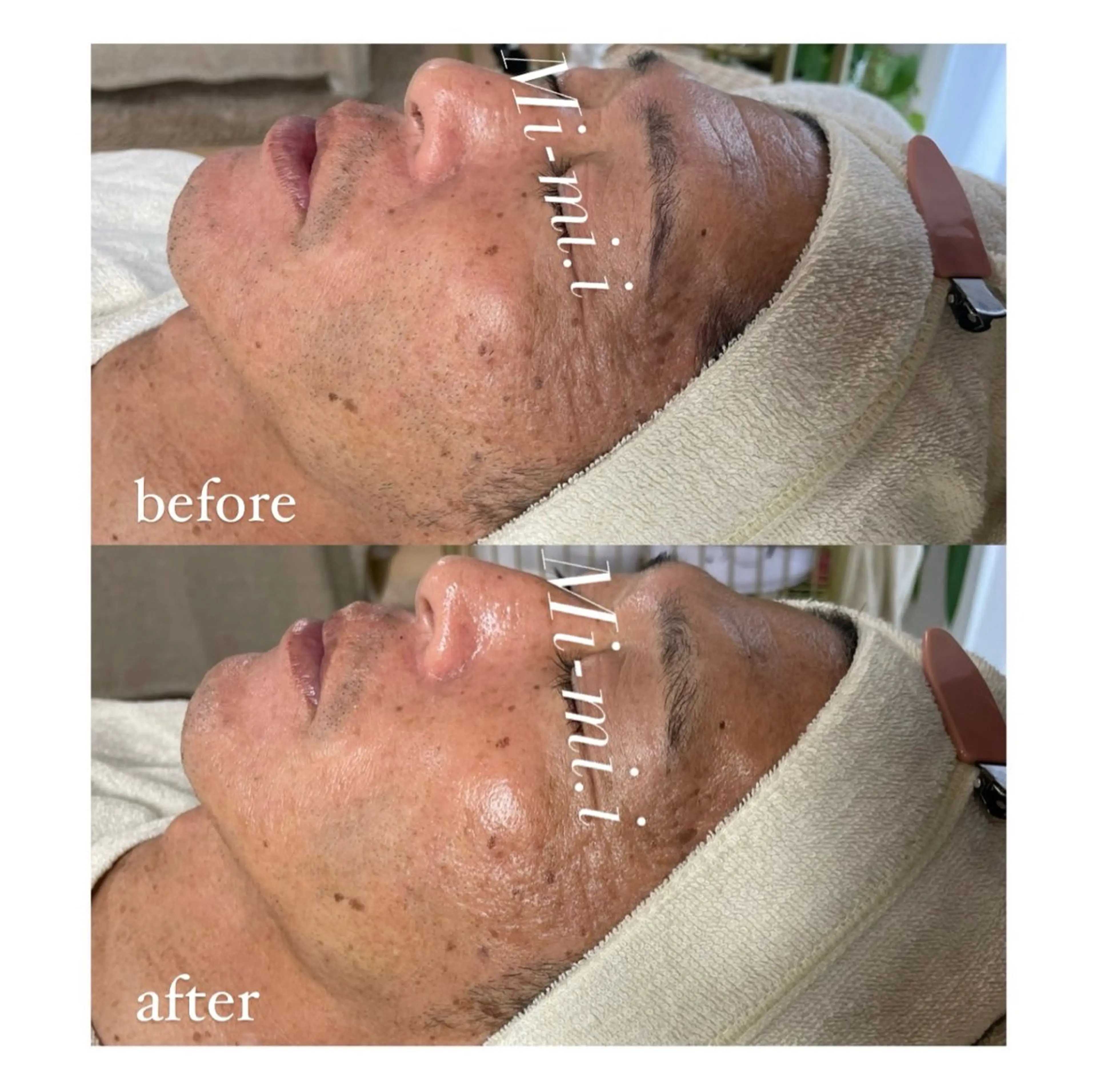 脱毛 エステサロン Mi-mi.iのエステ・リラクイメージ