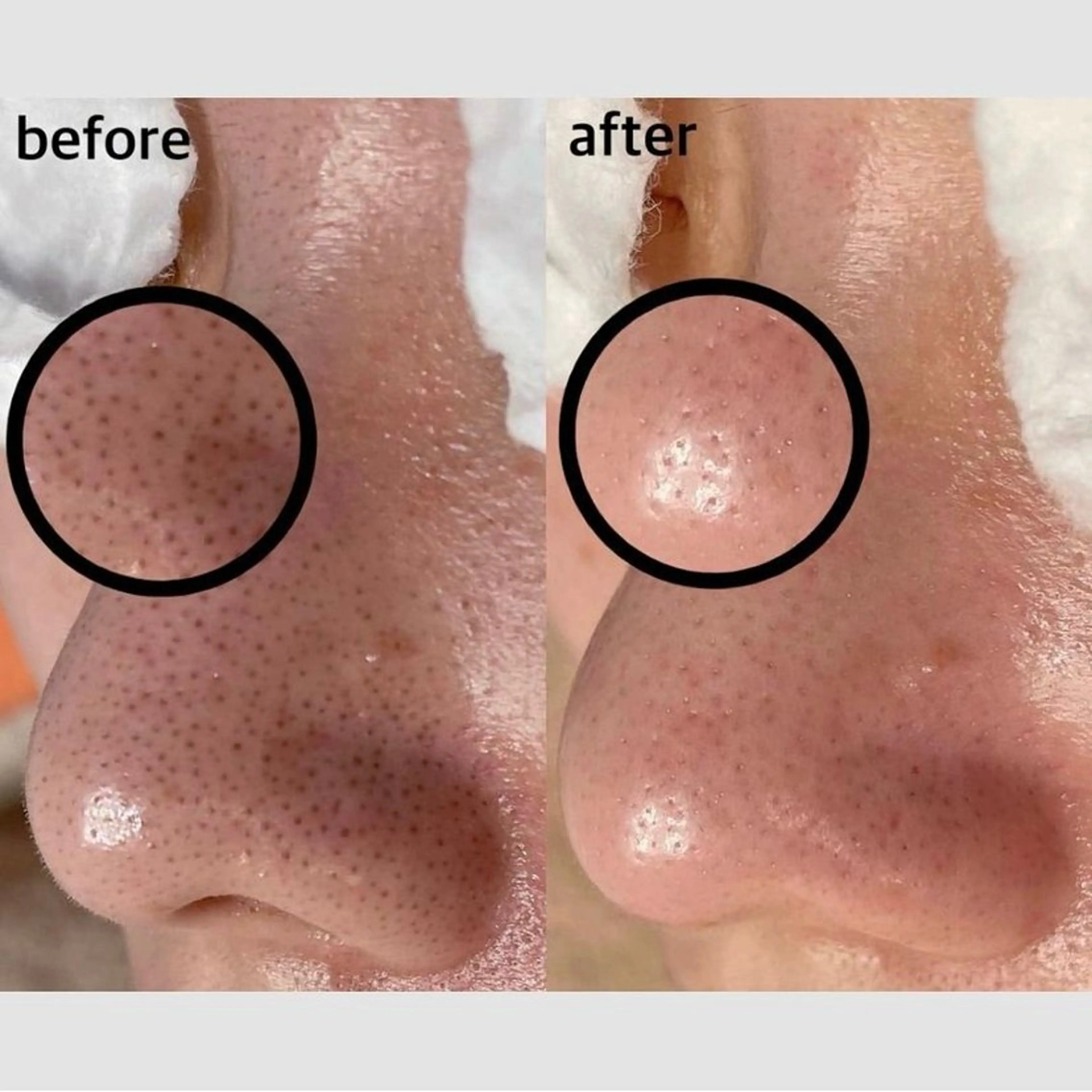 エステ リラク 韓国肌管理 【毛穴専科】のエステ・リラクイメージ