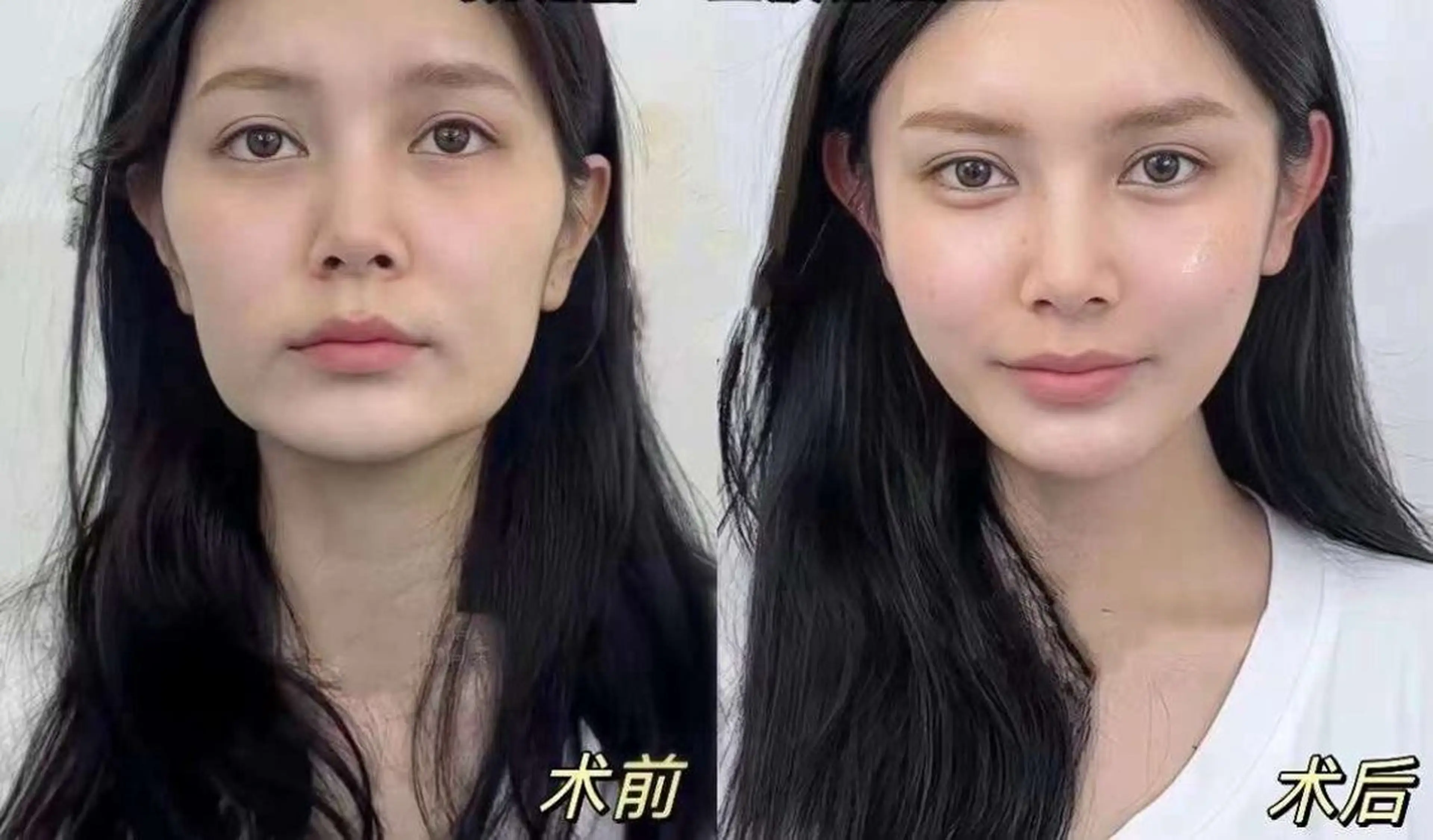 ネイル aliaハイフ&水光ジェットサロン所属・aliaハーブ水光店 エステティシャン募集のエステ・リラクイメージ