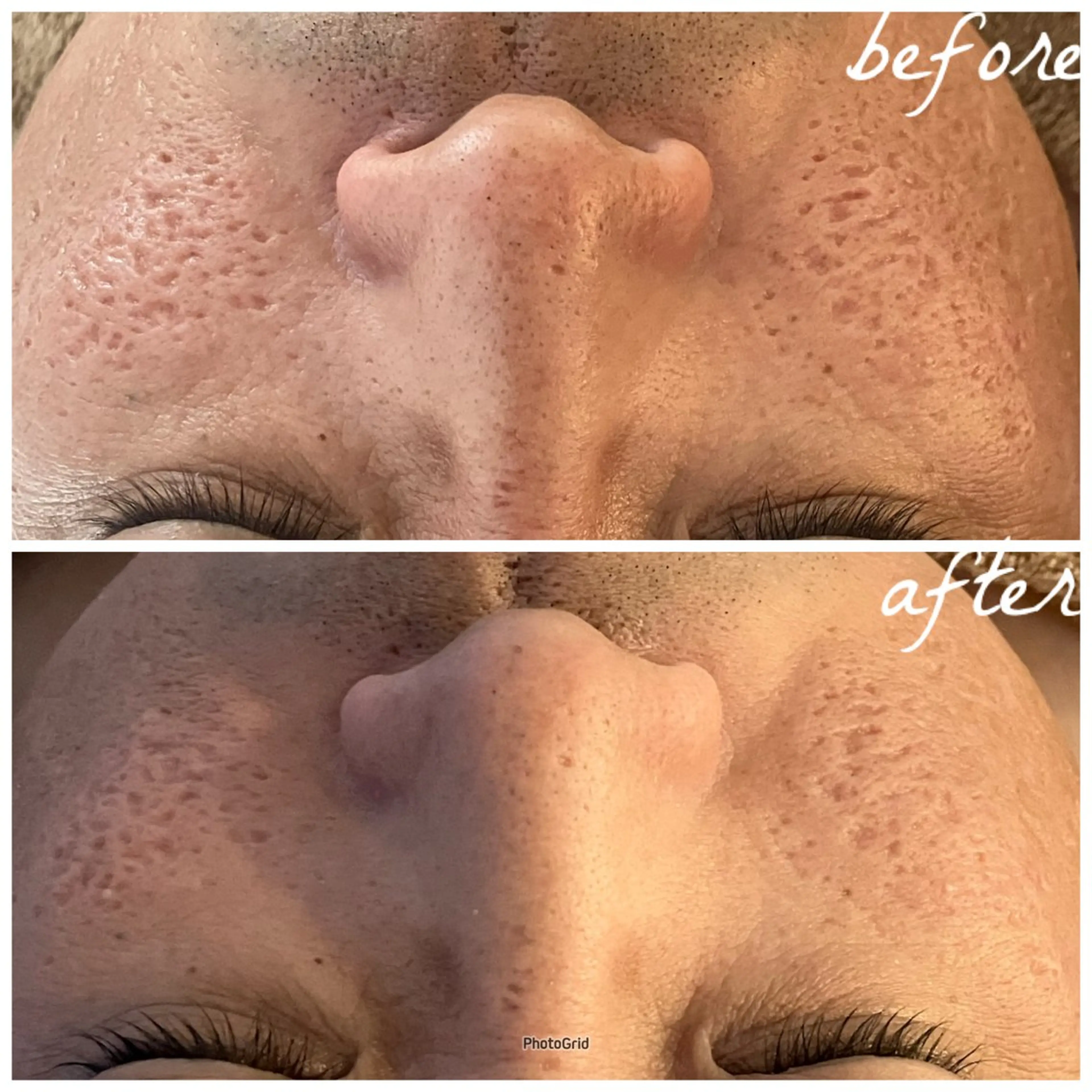 メンズ メナード岐阜茜部 杉浦のエステ・リラクイメージ