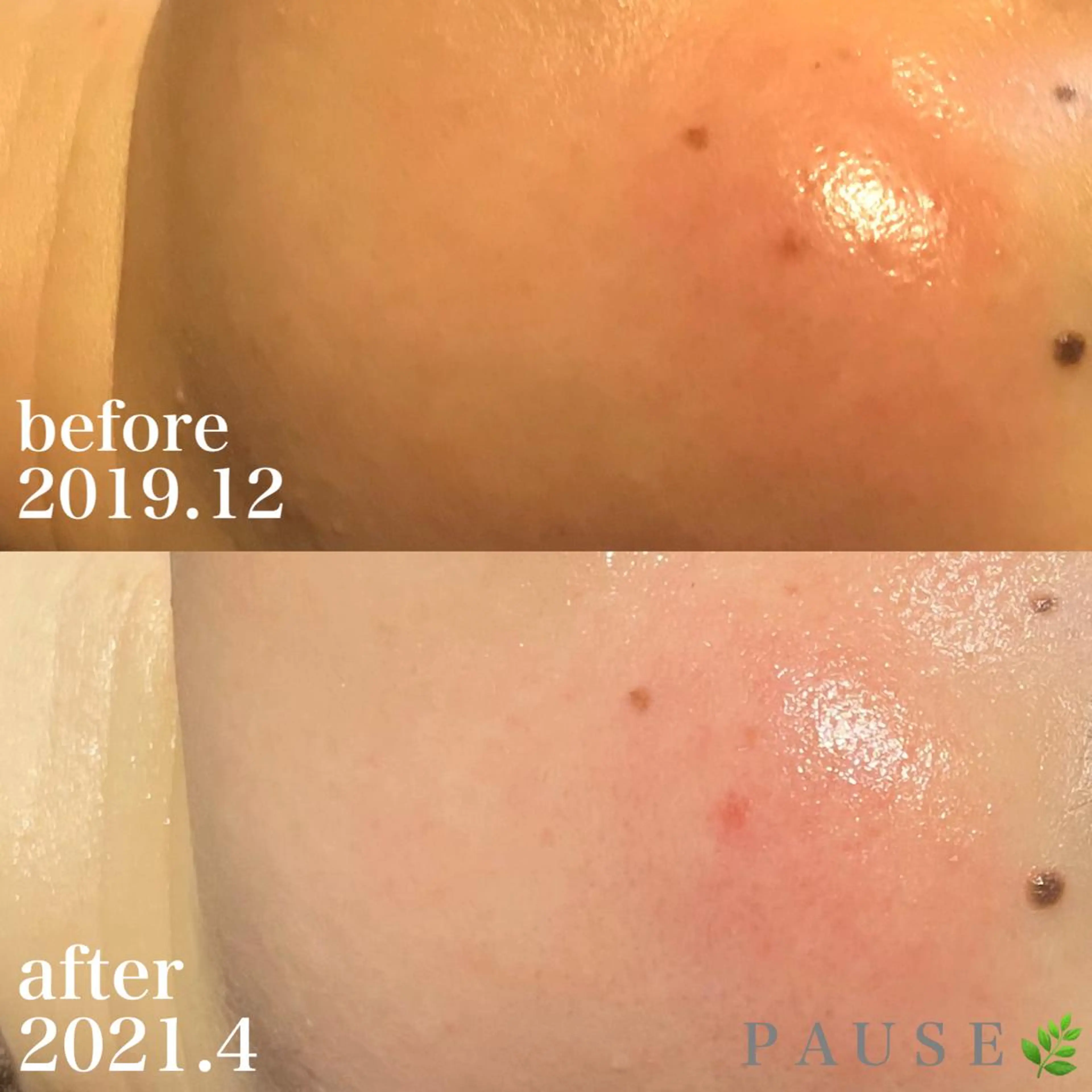 エステ リラク 浜野 恵美のエステ・リラクイメージ