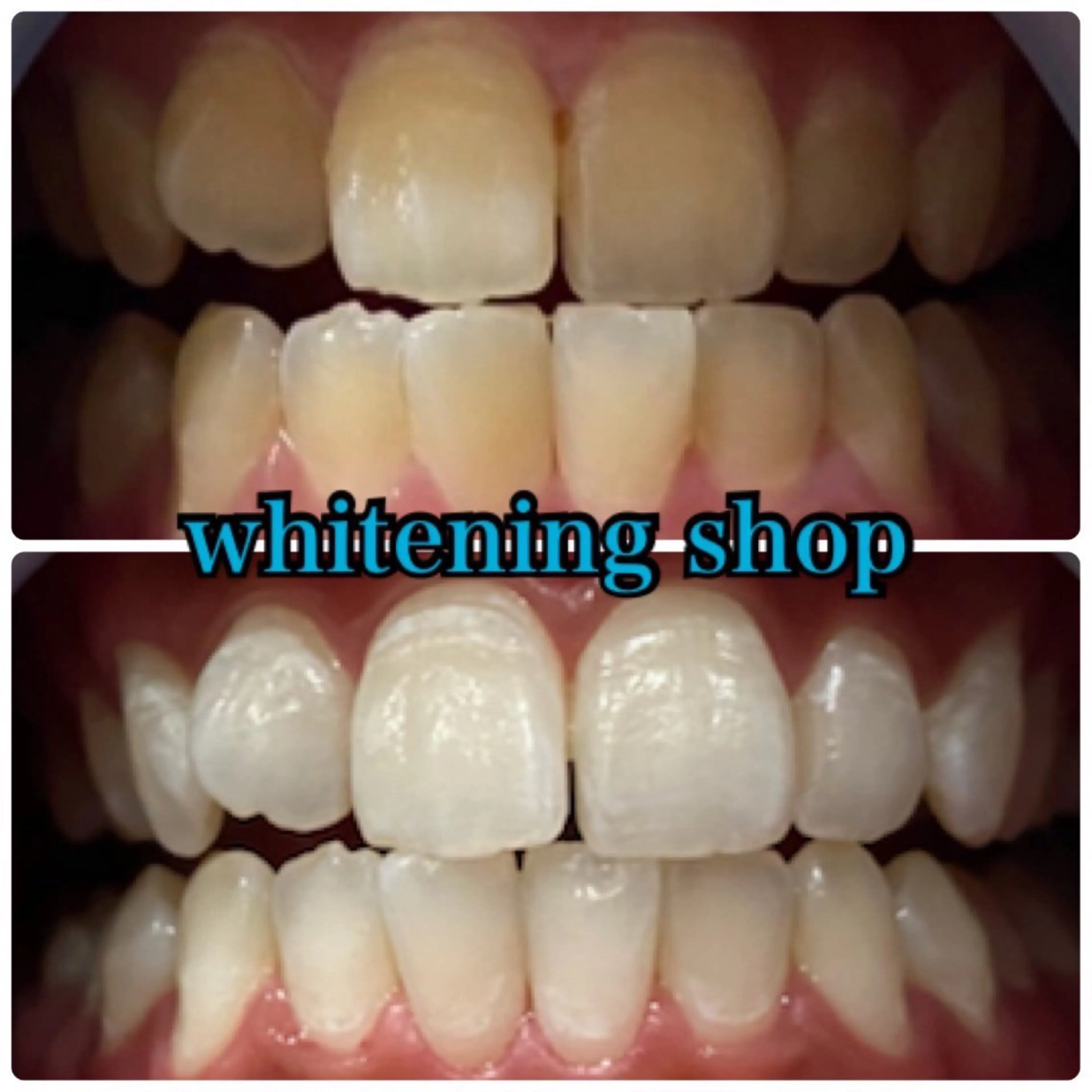 メンズ エステ リラク ホワイトニング ショップ川越店のエステ・リラクイメージ