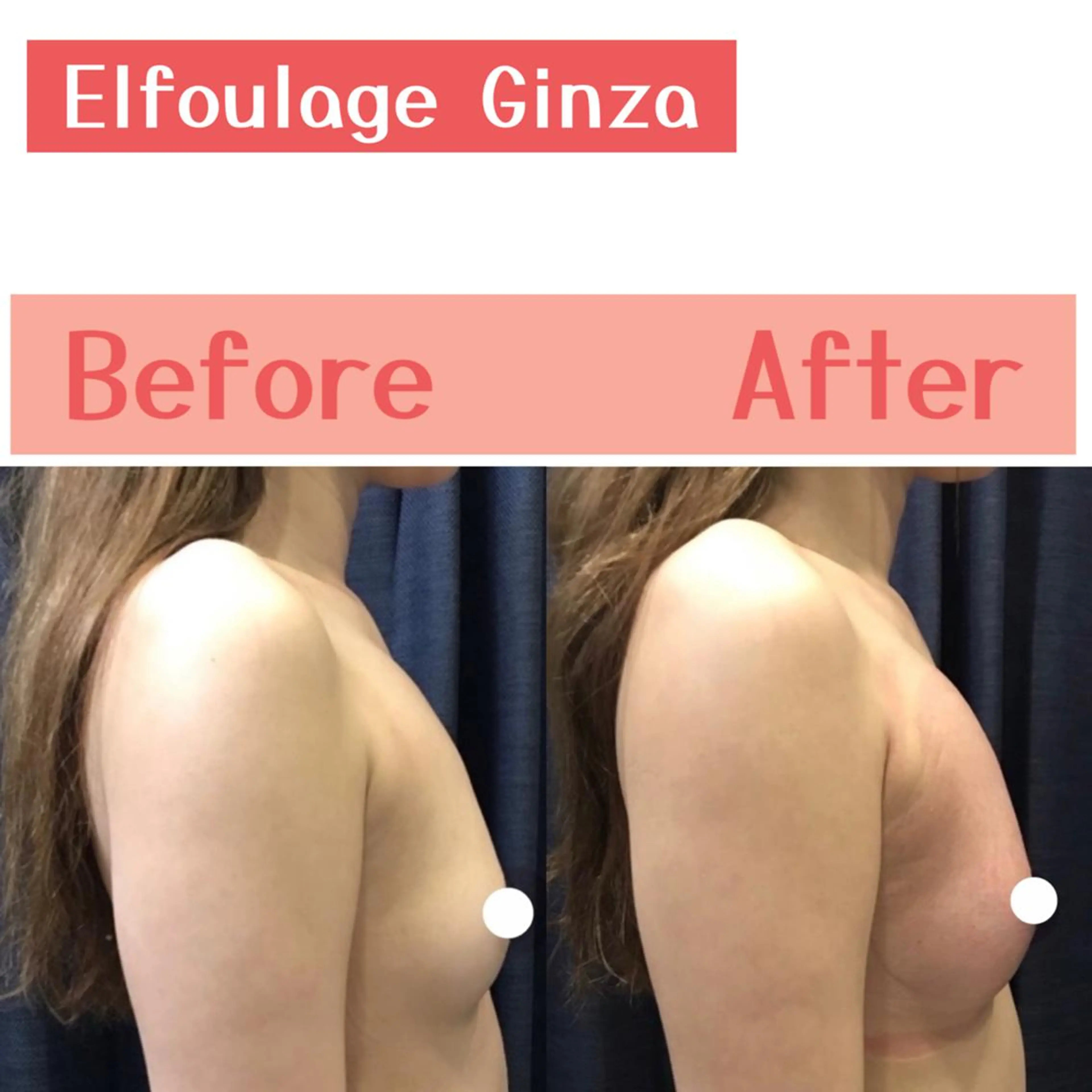 エルフラージュ 銀座店のエステ・リラクイメージ