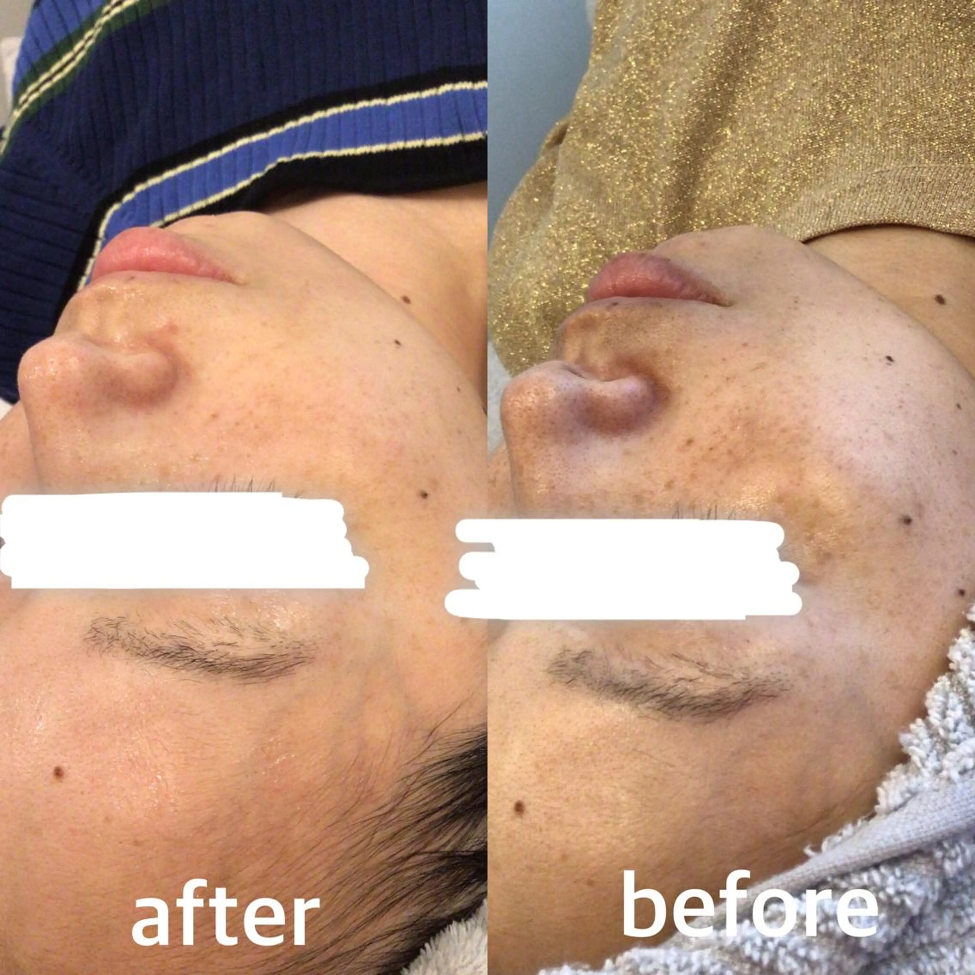 エステ Porte beauteオーナーのエステ・リラクイメージ