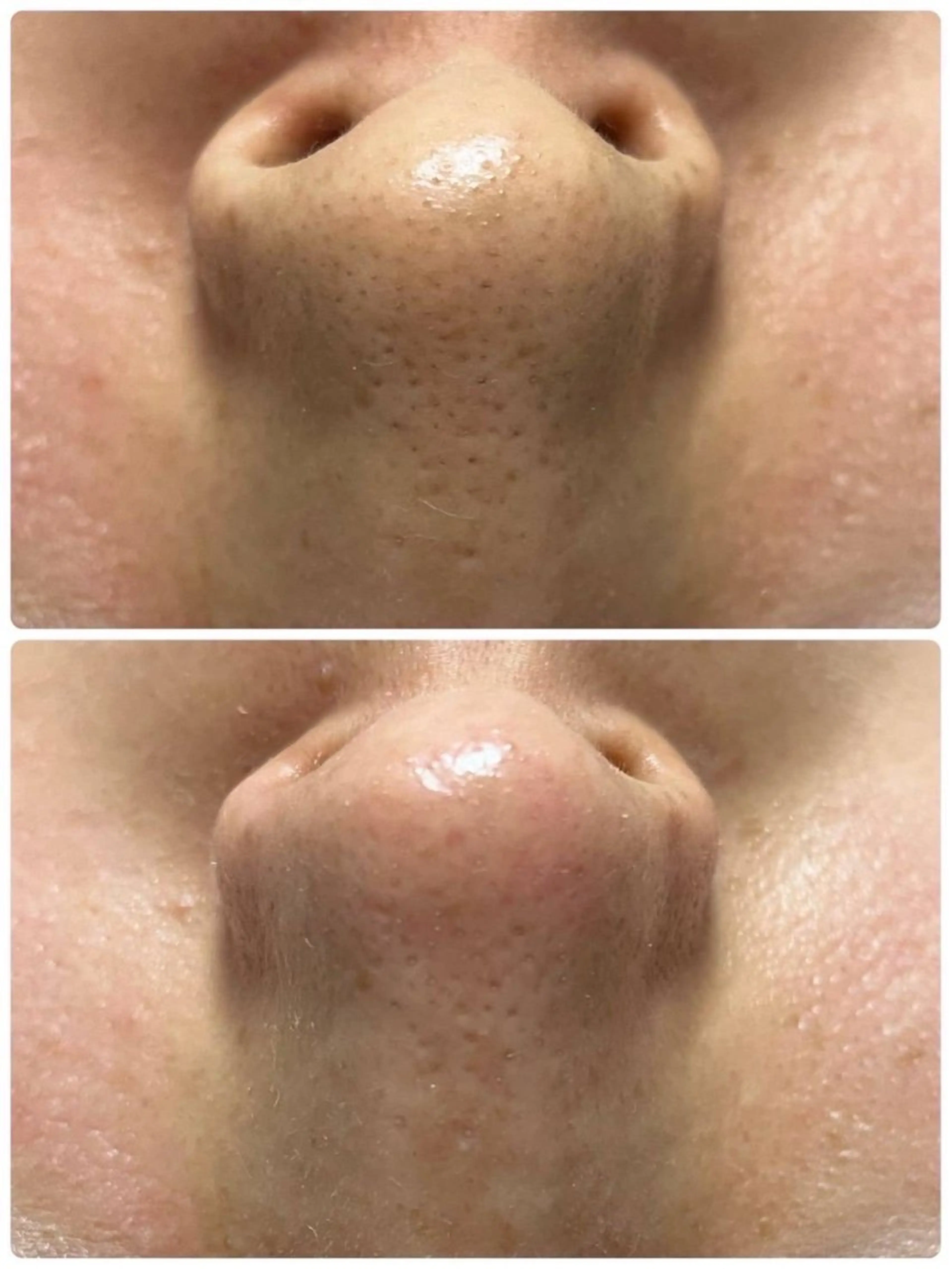 MOOR／ nanamiのマツエク・マツパデザイン