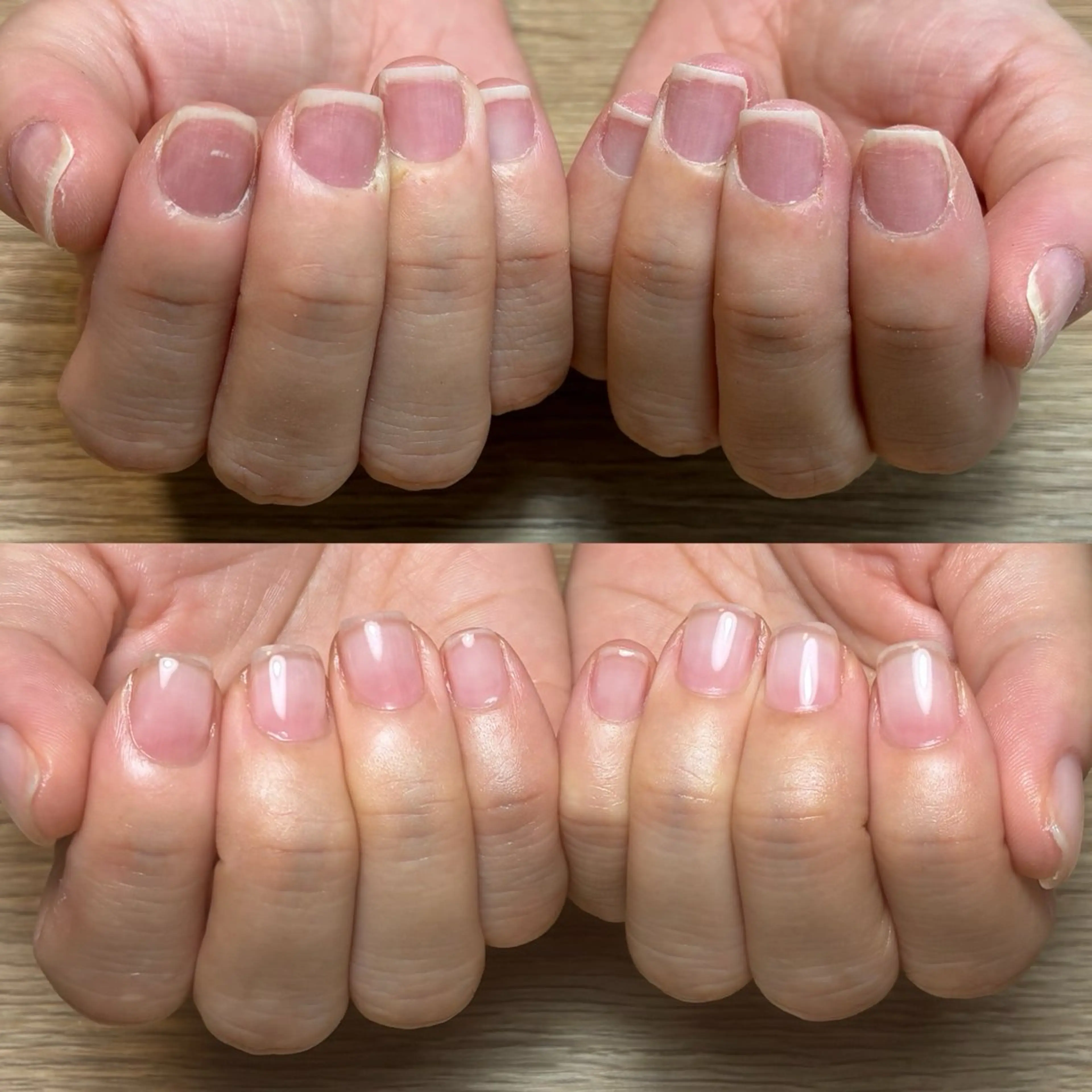 ネイル ピンク ハンドネイル ハンドケア 広島市南区(広島県) /深爪/自爪育成のネイルデザイン