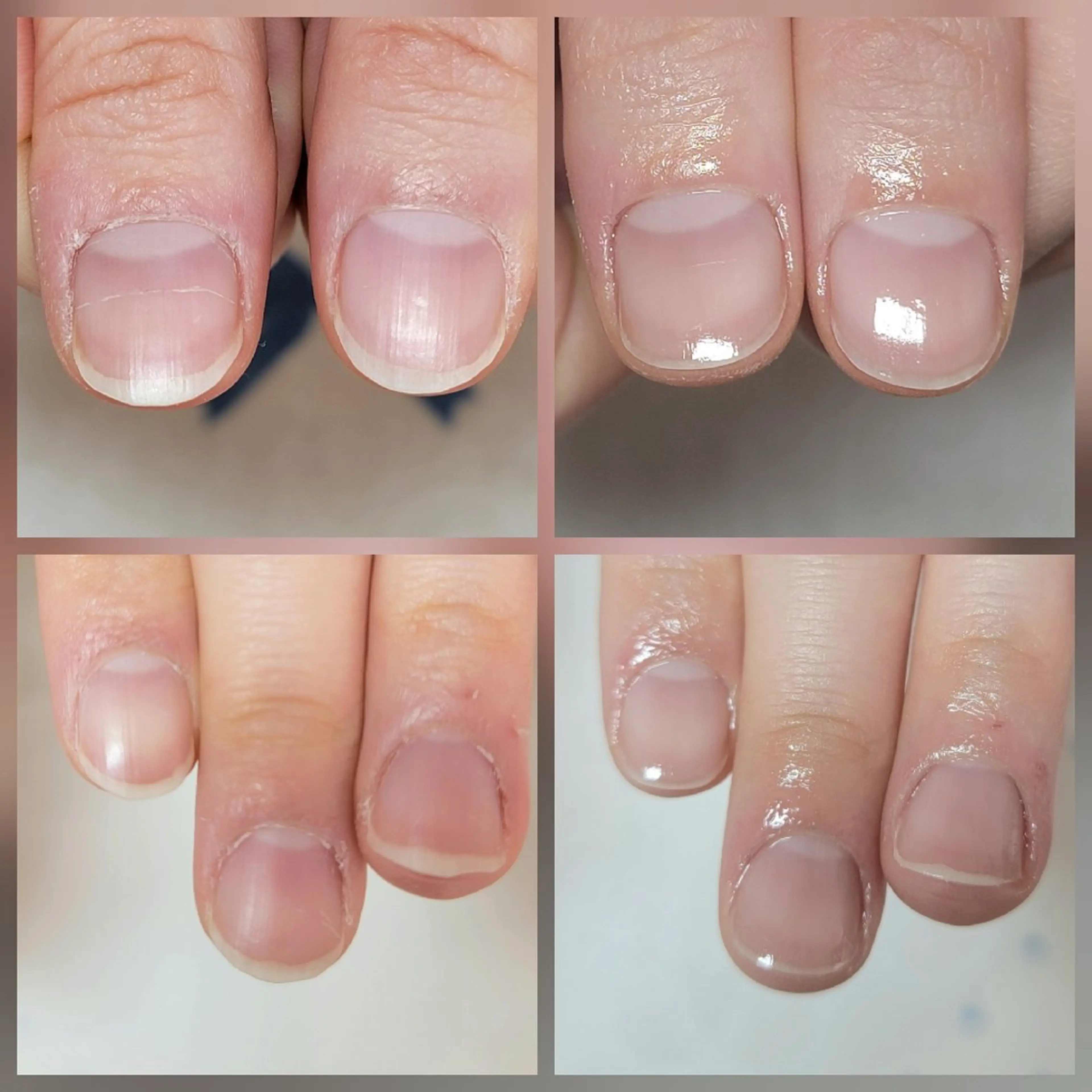 ネイル ネイル&巻き爪サロン AKnailのネイルデザイン