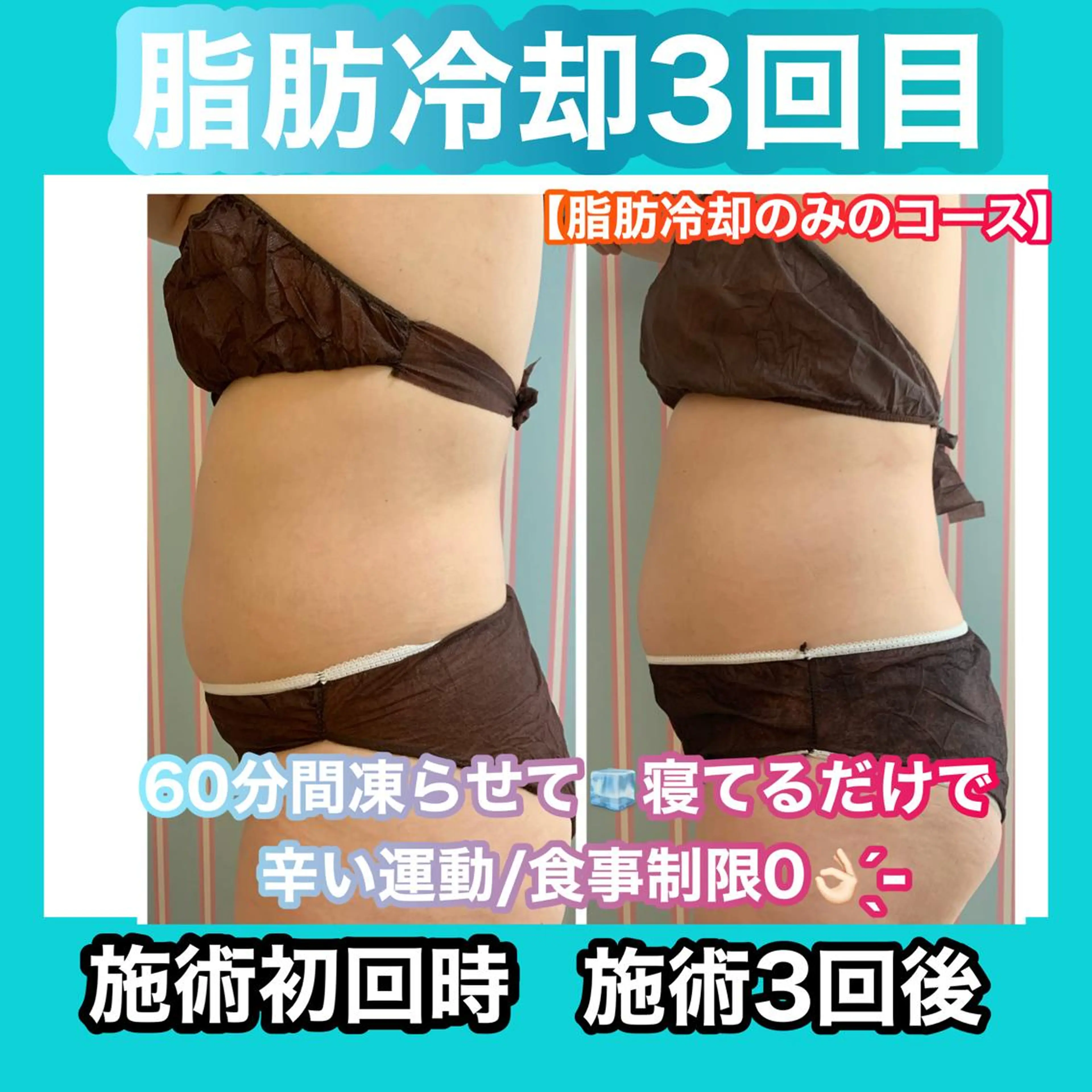 エステ リラク 痩身/脱毛/ネイル HARUKAのエステ・リラクイメージ