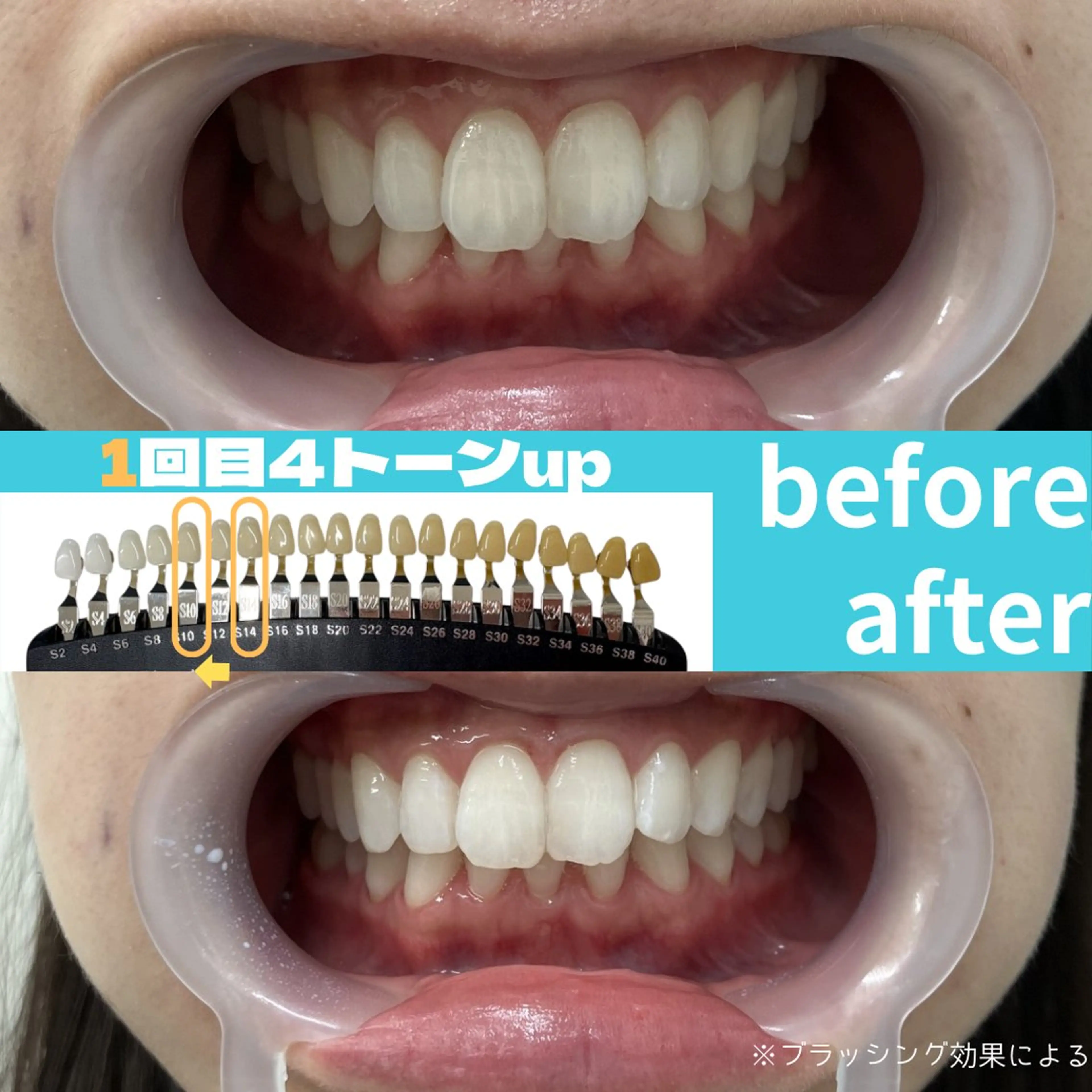 エステ s rikoのエステ・リラクイメージ