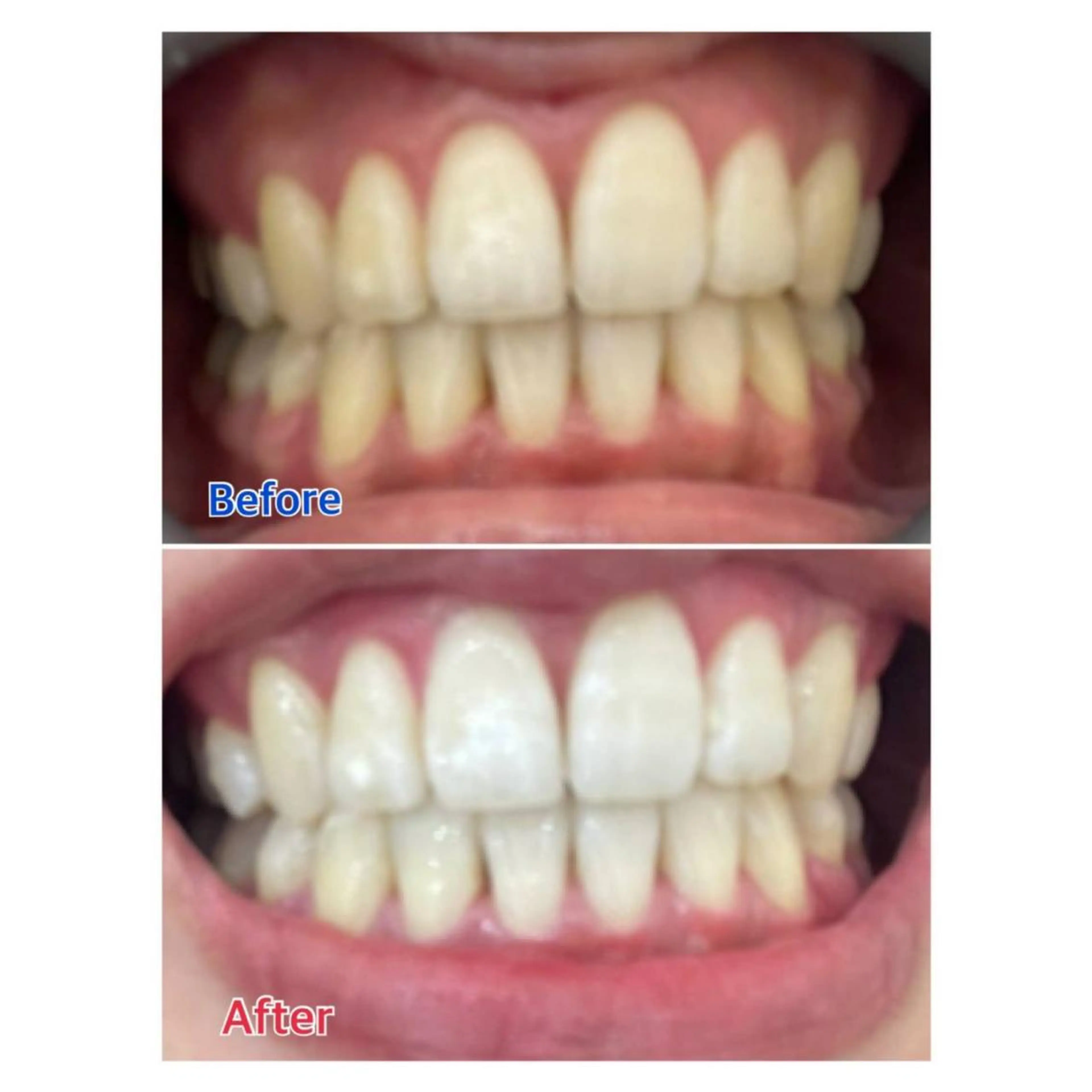 MBEAUTYSALON 千葉店・京成大久保所属・Melty 輝のその他イメージ