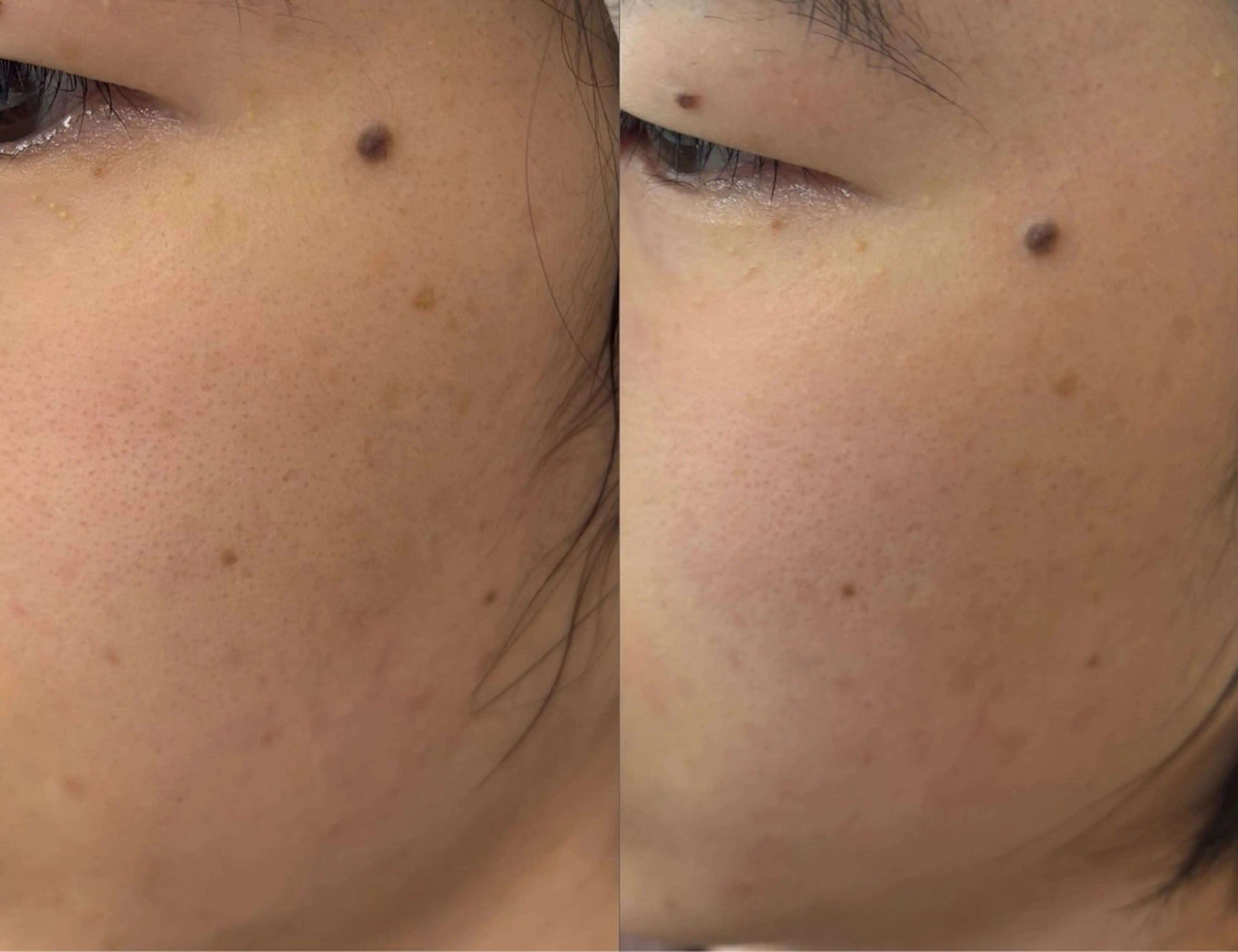 ナリス ビューティーステーション デ・アイム 有田所属・西谷 ゆめのエステ・リラクイメージ