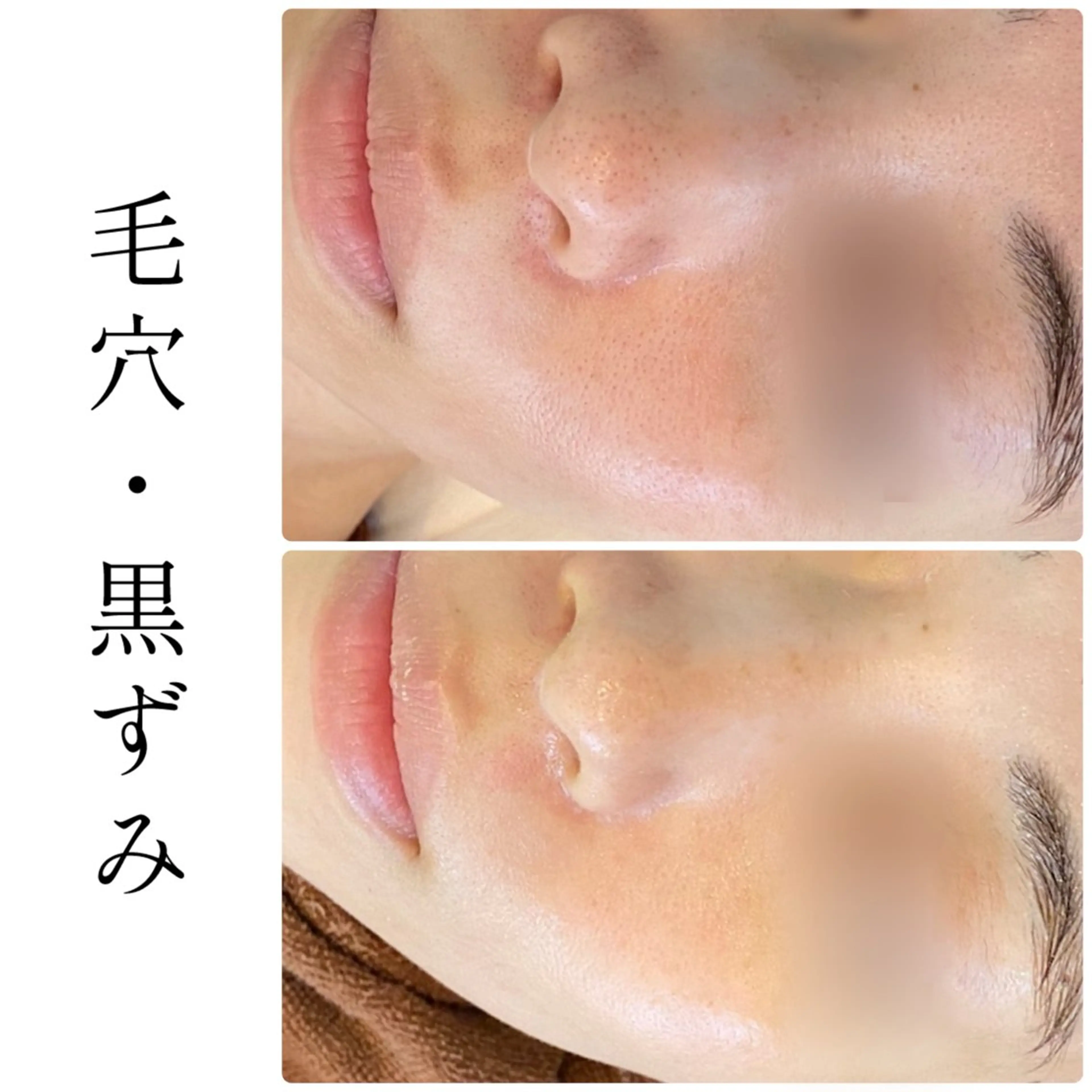 エステ ハーブピーリング専門 BIOEL横浜のエステ・リラクイメージ